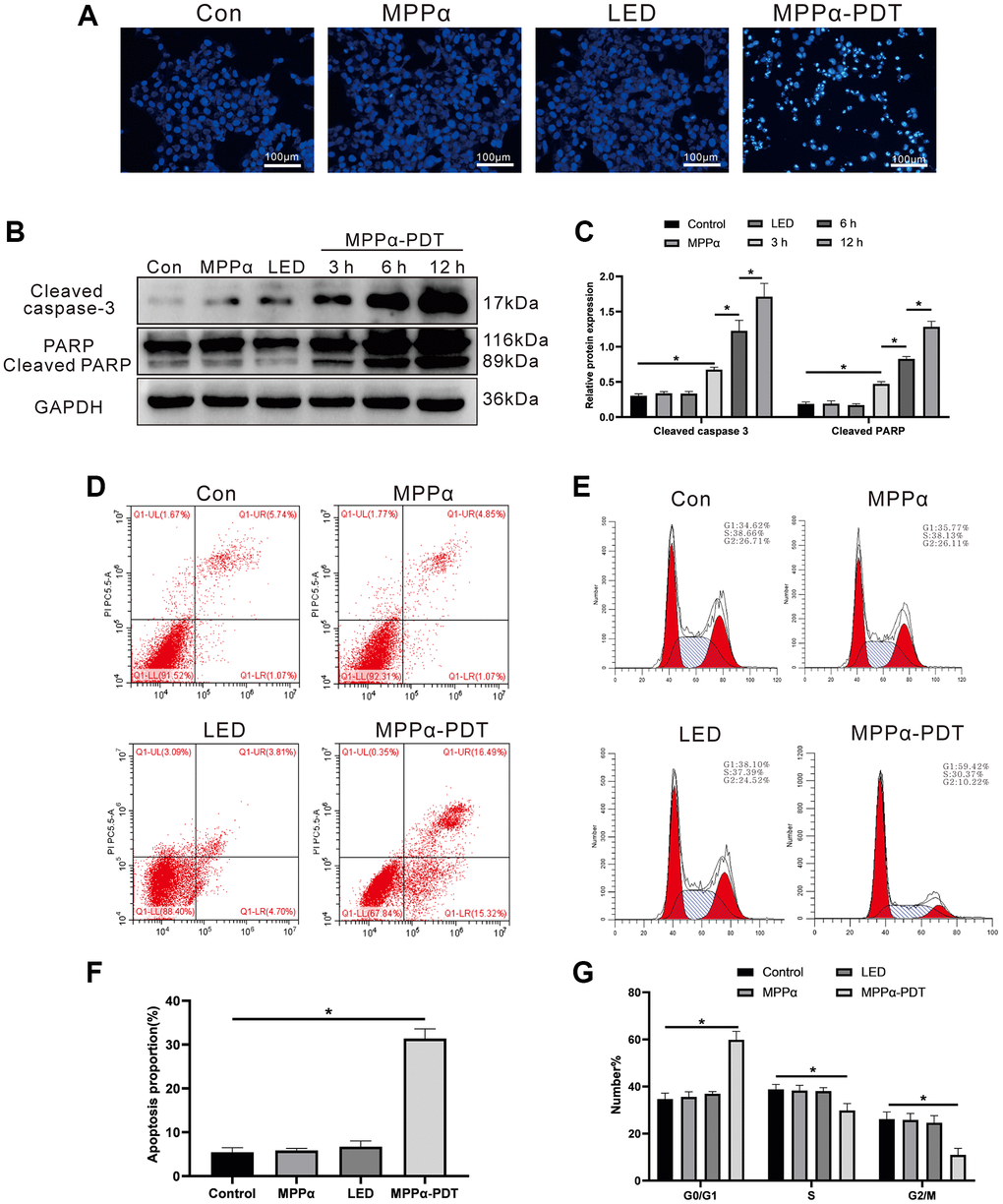 MPPα-PDT induces HOS cells cycle arrest and apoptosis. (A) HOS cells nuclei were examined for apoptotic morphological changes under a fluorescence microscope (magnification: ×200) after MPPα-PDT treatment for 12 h. (B, C) Cells were harvested after MPPα-PDT treatment for 3, 6, and 12 h and western blot used to evaluate cleaved caspase-3 and cleaved PARP levels. (D–F) Apoptosis was determined by flow cytometry. (E–G) Cell cycle distribution was analyzed using flow cytometry. *P 