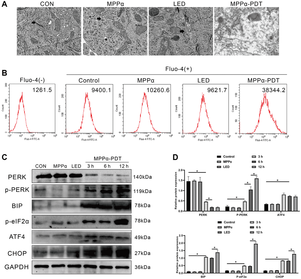 ER stress and PERK-eIF2α-ATF4 signaling pathway activation are induced by MPPα-PDT in HOS cells. (A) ER morphology was observed by TEM (magnification, ×20000). (B) Intracellular Ca2+ concentration was quantified by flow cytometry using Fluo-4-AM probe. (C, D) MPPα-PDT treated cells were harvested after 3, 6, and 12 h and PERK, p-PERK, BIP, p-eIF2α, ATF4, and CHOP, levels determined by western blot. Data are shown as mean ± SD of 3 independent experiments. *P 