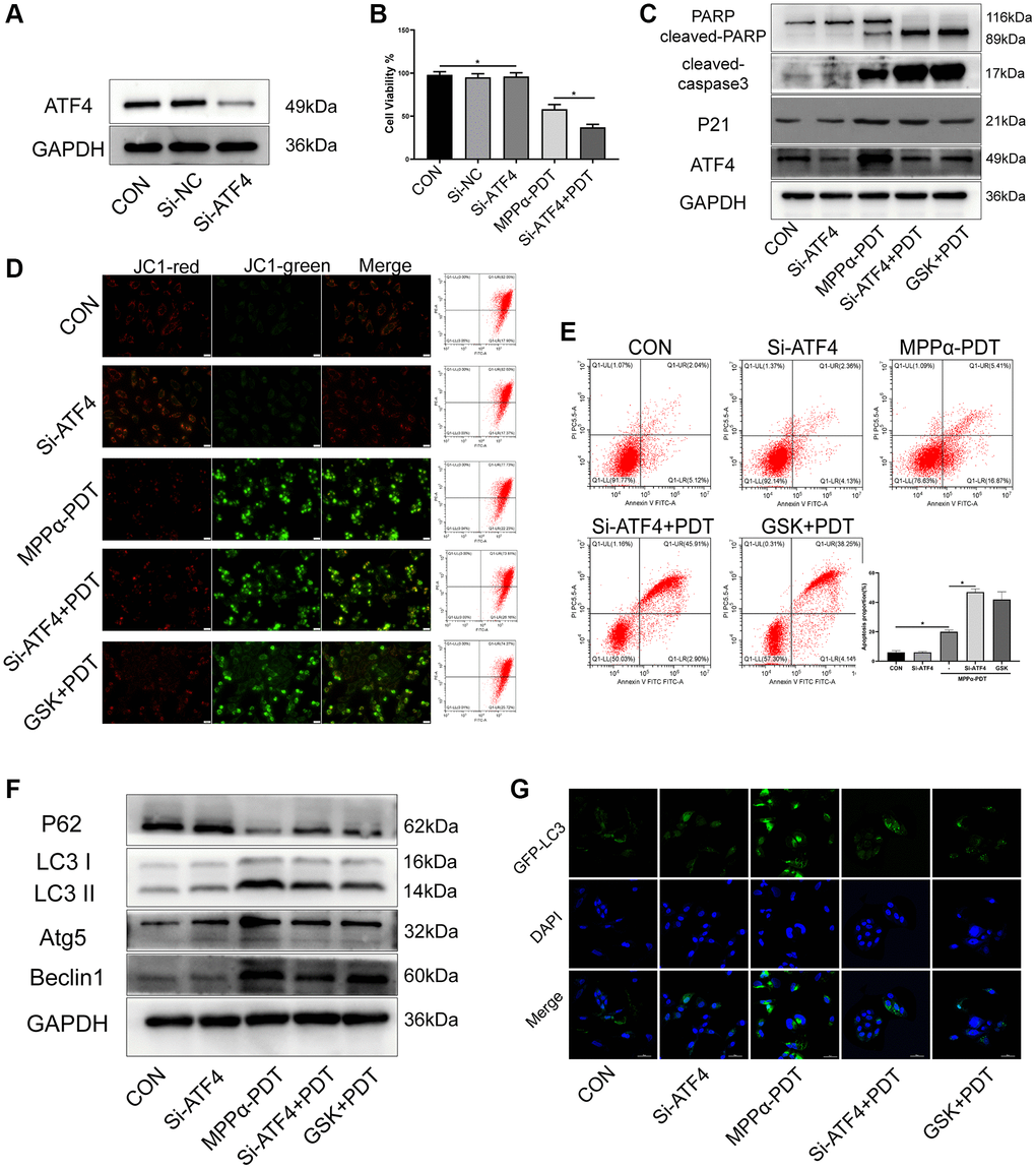 Targeting ATF4 increases the sensitivity of PDT by inhibiting autophagy. HOS cells in MPPα-PDT+GSK2656157 group were pretreated with 5 mM GSK2656157 for 1 h before MPPα-PDT treatment. HOS cells were transfected with siRNAs and then treated with MPPα-PDT. (A) Protein ATF4 or mRNA ATF4 was detected by western blot and represents the transfection efficiency. (B) Cell viabilities were detected by CCK-8 after treated with SiRNA-ATF4 (Si-ATF4), SiRNA-negative control (Si-NC), MPPα-PDT and group MPPα-PDT combined with Si-ATF4. (C) Following indicated treatments, cells were harvested and ATF4, p21, PARP and cleaved caspase-3 levels determined by western blot. (D, E) Apoptotic rate or JC-1 stain was examined by flow cytometry or fluorescence microscope (×200). (F) Following indicated treatments, cells were harvested and LC3, P62, Atg5 and Beclin1 levels were determined by western blot. (G) Adenovirus-GFP-LC3 was transfected into the HOS cells after treated, the LC3 fluorescent particles were observed by laser confocal microscope (×400). *P 