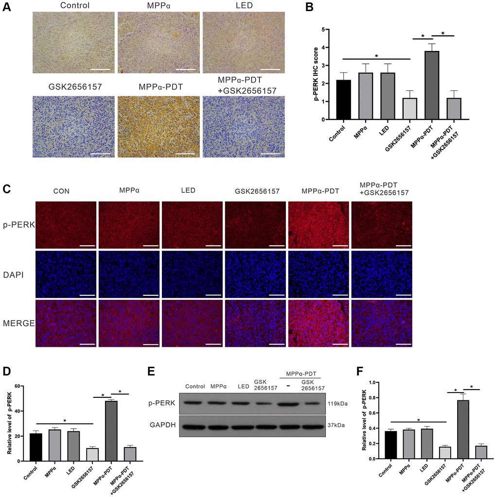 p-PERK in vivo levels upon indicated treatments. (A, B) IHC analysis of p-PERK levels in tumor sections (magnification, ×200). (C, D). Fluorescence analysis of p-PERK levels in tumor sections (magnification, ×400). (E, F) Following indicated treatments, tumor tissues were analyzed by western blot for p-PERK levels. Data are shown as mean ± SD of 3 independent experiments. aP bP 