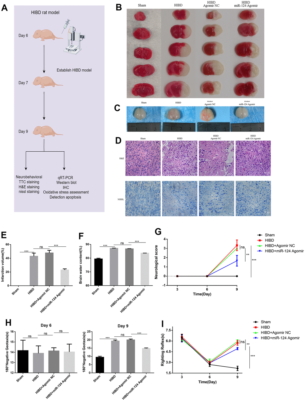 MiR-124 attenuates the brain infarct volume, brain oedema, and neuronal damage, while improving the neurological reflex behavior of rats with HIBD in vivo. (A) Overview of animal experiments procedures in the HIBD rat model; (B) Representative TTC stained coronal brain sections of each group (number of animals: n=5/group); (C) Representative images of newborn SD rat brain taken by digital camera after HI injury (number of animals: n=5/group); (D) Nissl staining and H&E staining of cerebral cortex region in each group(number of animals: n=5/group). Scale bar, 50μm; (E) Quantitative analysis of ipsilateral cerebral infarction volume in each group; (F) Quantitative analysis of brain water content; (G) Neurological score (number of animals: n=10/group); (H) Righting reflex times (number of animals: n=10/group); (I) Negative geotaxis reflex times (number of animals: n=10/group); Data are expressed as the mean ± SD. P p > 0.05, * p p p 