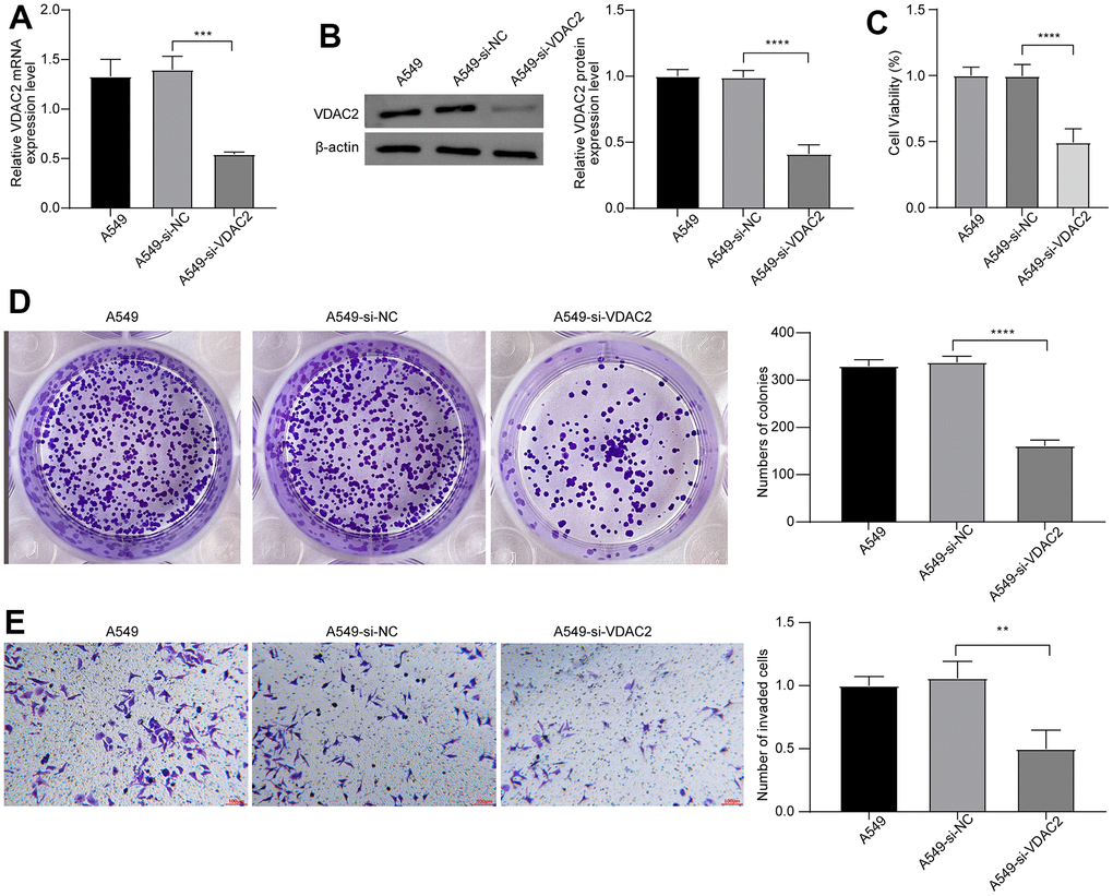 Suppression of VDAC2 expression might inhibit proliferation and invasion of NSCLC in vitro. The levels of VDAC2 mRNA expression (A) and protein expression (B) in A549-si-VDAC2 group detected via qPT-RCR and western blot. (C) Cell viability was measured by CCK8 assay. (D) Cell proliferation was detected by clonogenic assay. (E) Invasion ability of cells was detected via transwell assay. ** ppp