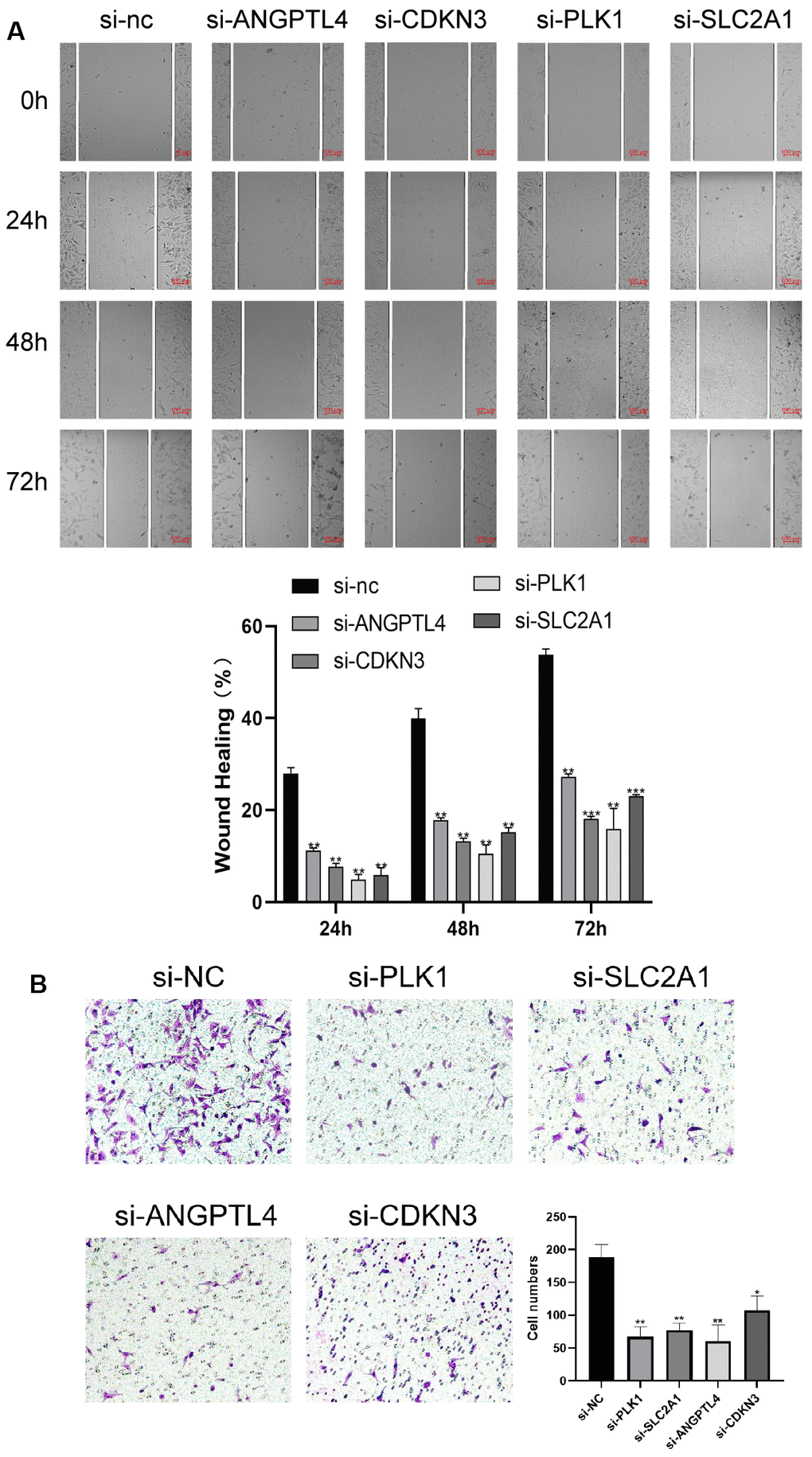 ARGs promote LUAD cell proliferation and migration. (A) Knockdown of 4 ARGs attenuated wound closure in A549 cells (n = 3). (B) Silencing 4 ARGs attenuated invasion in A549 cells. The error bars indicate the mean ± SD, and each experiment was repeated at least three times. *P 