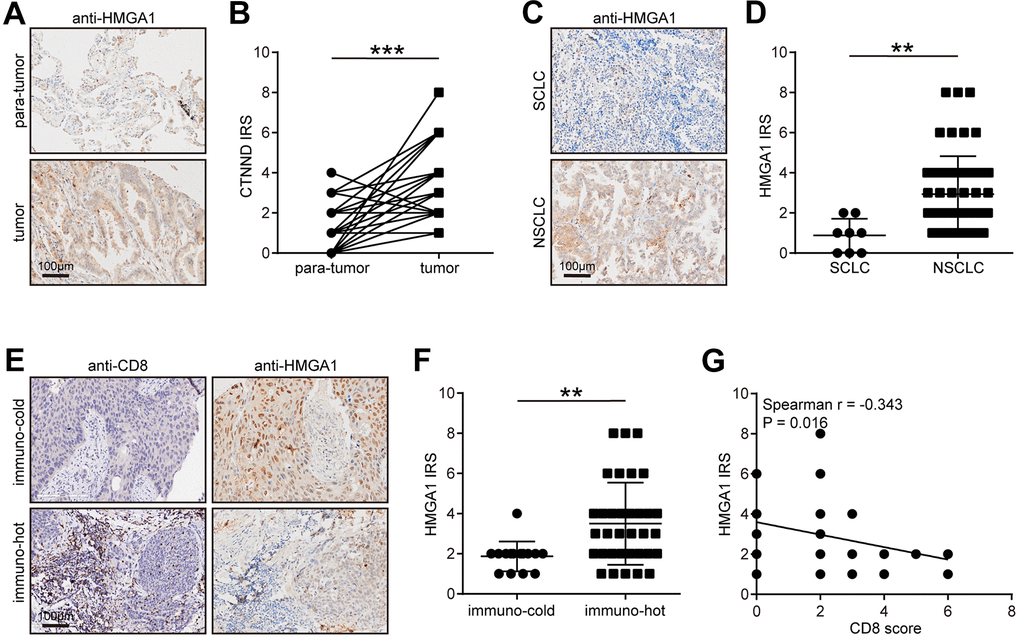 Validation of CTNND1 expression and its correlations with the TME features in the in-house cohort. (A, B) Representative images uncovering the expression of HMGA1 in para-tumor and tumor tissues and quantitative analysis. (C, D) Representative images uncovering the expression of HMGA1 in NSCLC and SCLC tumor tissues and quantitative analysis. (E, F) Representative images uncovering the expression of HMGA1 in immuno-cold and immuno-hot tumor tissues and quantitative analysis. (G) Correlation between HMGA1 expression and CD8 score.