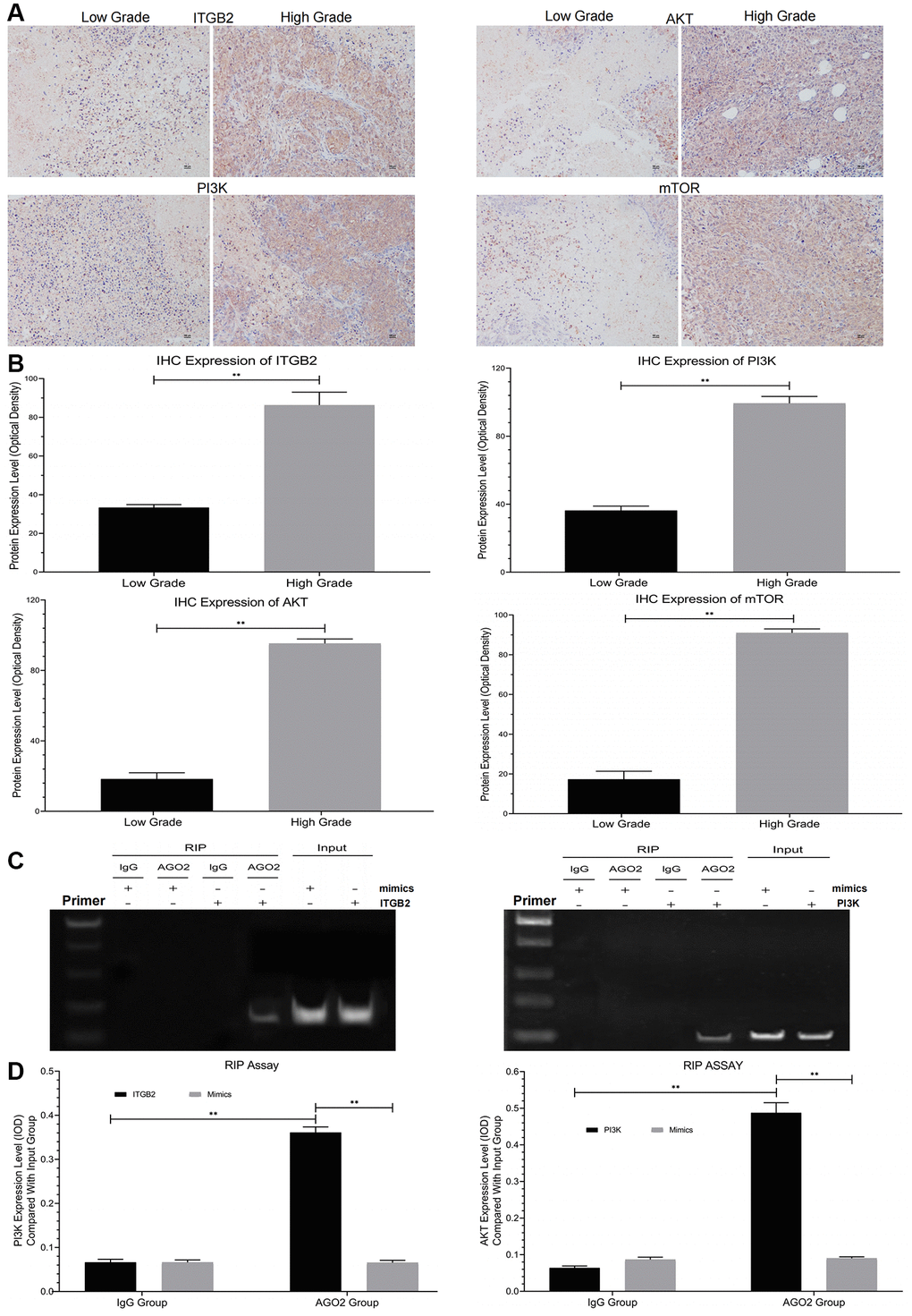 Detection of signal pathway expression in clinical ovarian cancer samples and RIP assay. (A, B) Immunohistochemical detection of ITGB2-PI3K-AKT-mTOR in different grades of ovarian cancer tissues (FIGO I-IV) and data statistics. (C, D) RIP assays of signal pathway factors (ITGB2, AKT vs PI3K) and data statistics.