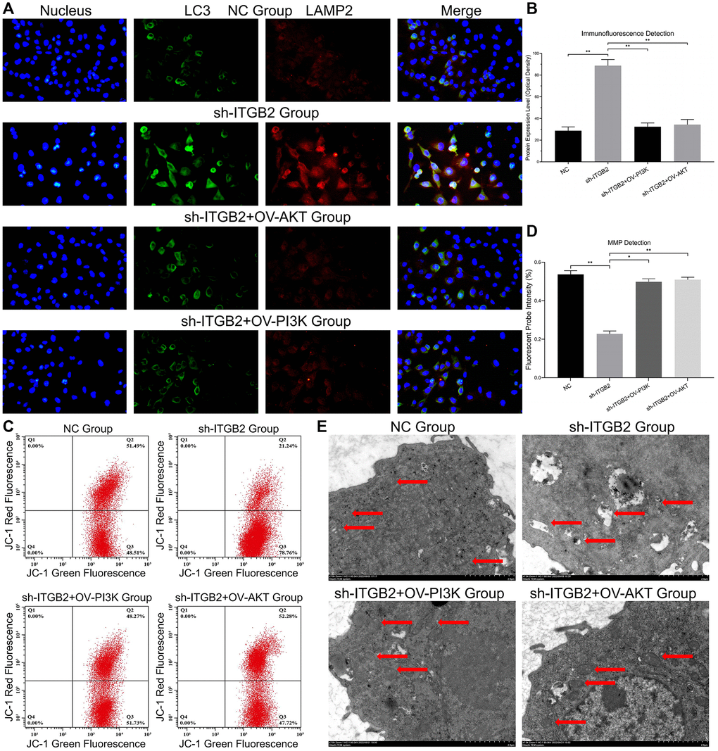 Mitophagy detection in ovarian cancer cells. (A, B) Immune co-localization detection of mitochondrial autophagy markers in ovarian cancer cell models and data statistics. (C, D) MMP detection in ovarian cancer cell models and data statistics. (E) TEM observation of mitophagy in ovarian cancer cells with different ITGB2 signal pathway expression.