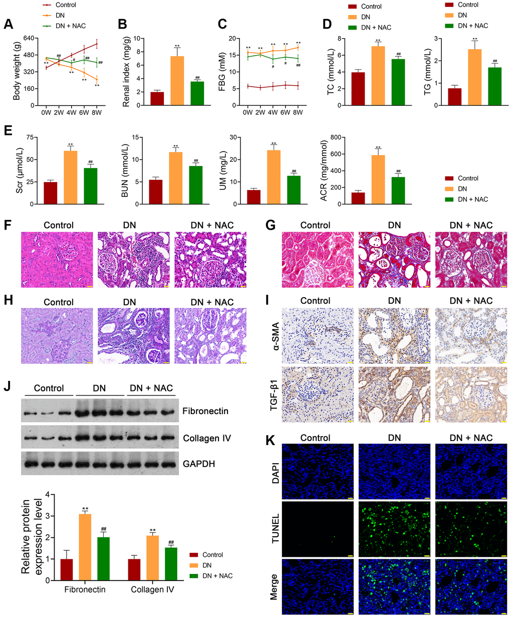 Inhibition of OS ameliorates the symptoms of DN in rats. (A–C) The body weights, renal index, and FBG levels of rats in each group. (D, E) Plasma TC, TG, Scr, BUN, UM, and ACR of rats in each group using enzymatic colorimetric assay and ELISA. (F–H) Histopathological examinations in the kidney tissues of rats in each group using HE, Masson, and PAS staining (scale bar = 20 μm). (I) The expression of α-SMA and TGF-β1 in the kidney tissues of rats in each group using immunohistochemistry (scale bar = 20 μm). (J) The expression of fibronectin and collagen IV in the kidney tissues of rats in each group using western blotting. (K) Cell apoptosis in the kidney tissues of rats in each group using TUNEL assay (scale bar = 20 μm). To explore the role of OS in DN development, DN rats were treated with or without the ROS inhibitor, N-Acetylcysteine (NAC; 20 mg/kg) for eight successive weeks. Data were expressed as mean ± standard deviation (n = 6/group). **p #p ##p 