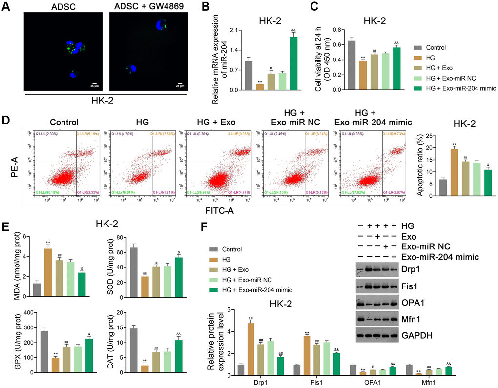 ADSC-derived exosomal miR-204 alleviates HG-induced injury in HK-2 cells. (A) Determination of ADSC-derived Exos taken up by HK-2 cells (human proximal renal tubular epithelial cell line) using PKH67 staining. ADSCs were pre-treated with GW4869 (an Exo inhibitor; 2.5 μM), followed by Exo isolation. HK-2 cells were then co-cultured with PKH67-labeled Exos to evaluate their capacity to take up Exos. (B) The expression of miR-204 in HK-2 cells using qRT-PCR. (C, D) HK-2 cell viability (at 24 h) and apoptosis assessed using CCK-8 and flow cytometry, respectively. (E) The levels of MDA, SOD, GPX, and CAT in HK-2 cells using ELISA. (F) The expression of Drp1, Fis1, OPA1, and Mfn1 in HK2 cells using western blotting. (B–F) HK-2 cells were exposed to HG (30 mM) and cultured for 24 h to construct an in vitro model of DN. To determine the function of exosomal miR-204 in DN, ADSCs were transfected with miR-204 mimic or miR NC (negative control) for 48 h. Then, Exos were separated from the transfected ADSCs and co-cultured with HK-2 cells for 12 h at the concentration of 100 μg/mL. Data were expressed as mean ± standard deviation. **p #p ##p &p &&p 