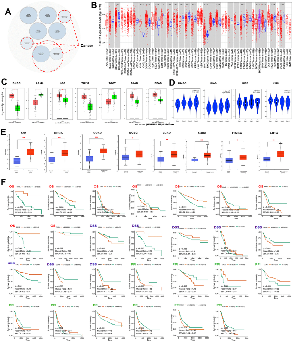 Differential expression of NUDT21 and predicted survival in pan-cancer. (A) Analysis of NUDT21 associated diseases using the Open Target web tool. The red dashed line indicates NUDT2 associated cancers. (B) Gene expression levels of NUDT21 in pan-cancerous tissues and its corresponding control tissues were analyzed using the TIMER2.0 method. Tumor and normal tissues are indicated in red and blue and SKCM metastatic tissues in purple, respectively. (C) Box plots of gene expression levels of NUDT21 in tumor and normal tissues of seven cancer types were plotted on GEPIA2.0. T and N represent tumor and normal tissues. (D) The expression levels of NUDT21 in four tumor types at four different stages were analyzed using the GEPIA2.0 method. (E) The UALCAN method was used to compare the protein expression differences of eight tumor tissues between normal and tumors tissues. (F) Kaplan-Meier curves were plotted to predict OS (red), DSS (blue) and PFI (green) in TCGA patients, * represents p