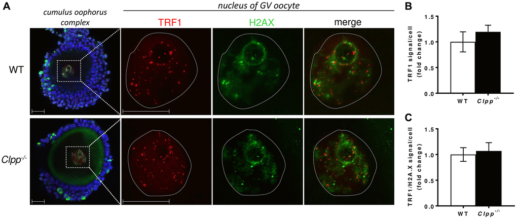 Representative confocal images of TRF1 expression and TRF/H2AX co-localization in cumulus oophorus isolated from 2-month-old wild-type and Clpp−/− mice. (A) Immunofluorescence double staining of TRF1 (red) and H2AX (green) in cumulus oophorus complexes of 2-month-old WT and Clpp−/− mice. Nuclear area of GV oocytes is highlighted by a dotted line. Nuclei were stained for TRF1 (red) and H2AX (green). DAPI (Blue) was used to stain nuclei (blue). The highlighted box in Clpp−/− sample shows co-localization of TRF1 and H2AX (white arrow). Scale bar = 25 μm. DAPI was used to stain nuclei (blue). (B) Quantitative analysis of TRF1 immunofluorescence in WT and Clpp−/− GV oocytes. (C) Quantitative analysis of co-localization of TRF1 and H2AX in WT and Clpp−/− GV oocytes. Data presented as mean ± SD with t-test (**p *p 
