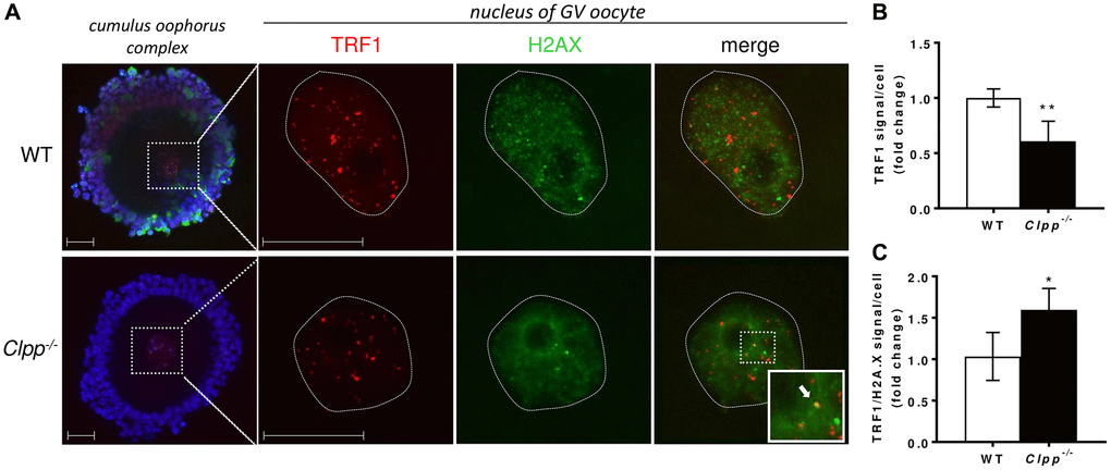 Representative confocal images of TRF1 expression and TRF/H2AX co-localization in cumulus oophorus isolated from 6-month-old wild-type and Clpp−/− mice. (A) Immunofluorescence double staining of TRF1 (red) and H2AX (green) in cumulus oophorus complexes of 6-month-old Clpp−/− and WT mice. Nuclear area of GV oocytes is highlighted by a dotted line. Nuclei were stained for TRF1 (red) and H2AX (green). DAPI (Blue) was used to stain nuclei (blue). The highlighted box in Clpp−/− sample shows co-localization of TRF1 and H2AX (white arrow). Scale bar = 25 μm. (B) Quantitative analysis of TRF1 immunofluorescence in WT and Clpp−/− GV oocytes. (C) Quantitative analysis of co-localization of TRF1 and H2AX in WT and Clpp−/− GV oocytes. Data presented as mean ± SD with t-test (**p *p 