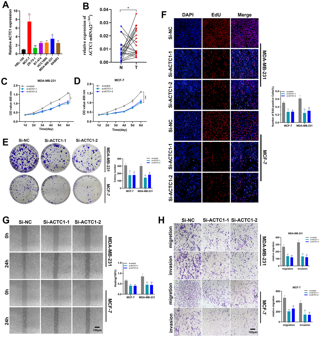 ACTC1 knockdown in vitro experiment. (A) RT-qPCR analysis was performed to verify the knockdown of ACTC1. (B) Expression analysis of ACTC1 in 20 pairs of BRCA tissue samples. (C, D) CCK-8 experiments. The activity of MDA-MB-231 and MCF-7 cell lines decreased significantly. (E) The cloning ability of MDA-MB-231 and MCF-7 cell lines decreased significantly. (F) EdU test. After ACTC1 knockdown, the proliferation ability of MDA-MB-231 and MCF-7 cell lines decreased significantly. (G) Healing test. After ACTC1 knockdown, the migration ability of MDA-MB-231 and MCF-7 cell lines decreased significantly. (H) Transwell assay. The migration and invasion abilities of MDA-MB-231 and MCF-7 cell lines were significantly decreased (*PP P***