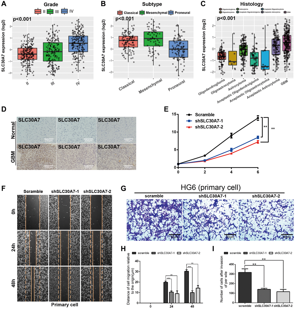 The expression of SLC30A7 and its effect on proliferation, invasion, migration and epithelial mesenchymal transformation of primary GBM cells. (A–C) Boxplots showing the SLC30A7 distributions according to grade, molecular subtype, and histology in CGGA cohort (P D) Expression of SLC30A7 in normal tissues and GBM. (E) Proliferation of cells stably transfected with SLC30A7 knockdown lentivirus in different group. Significant results are indicated as **p F–I) Cell scratch and Trans-well assays detected the invasion and migration of GBM primary cells after inhibition of SLC30A7, H is the statistic of the migration distance in scratch assay at different time points, I is the counting of the invasion penetrated out chamber cells after Transwell assay. Significant results are indicated as **p ***p 