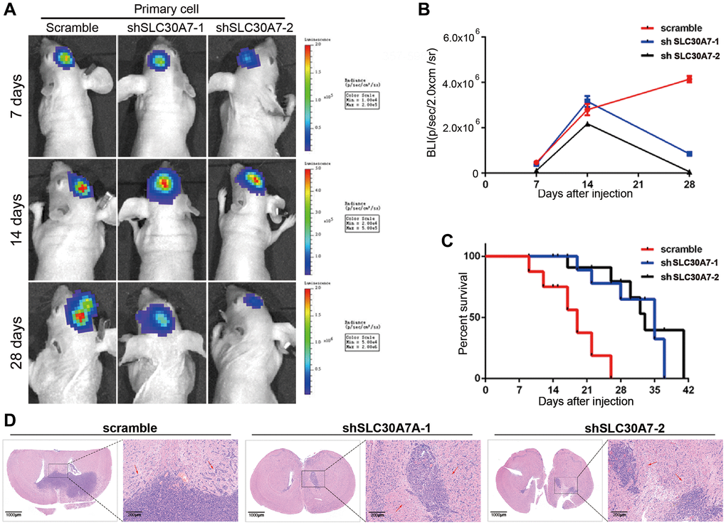 Detection of tumorigenesis of SLC30A7 stably knocked down in nude mouse orthotopic implanted tumour model. (A) Representative images of bioluminescence of mice on days 7, 14, and 28 after implantation. (B) Quantitative analysis of these bioluminescence images for the Scramble, shSLC30A7-1 and shSLC30A7-2 treatment groups. Data are shown as the mean ± S.D. n = 6, ****P t-test. (C) The overall survival of mice in different groups. Data are shown as the mean ± S.D. n = 6, NSP > 0.05, **P D) Representative images of the HE (×4 magnification, scale bar = 1000 μm) and HE staining in local area enlargement of tumour (×40 magnification, scale bar = 200 μm). The three rows of HE samples are repeated data from different processing groups. The outlined sections of left images were defined as higher magnification sections right.