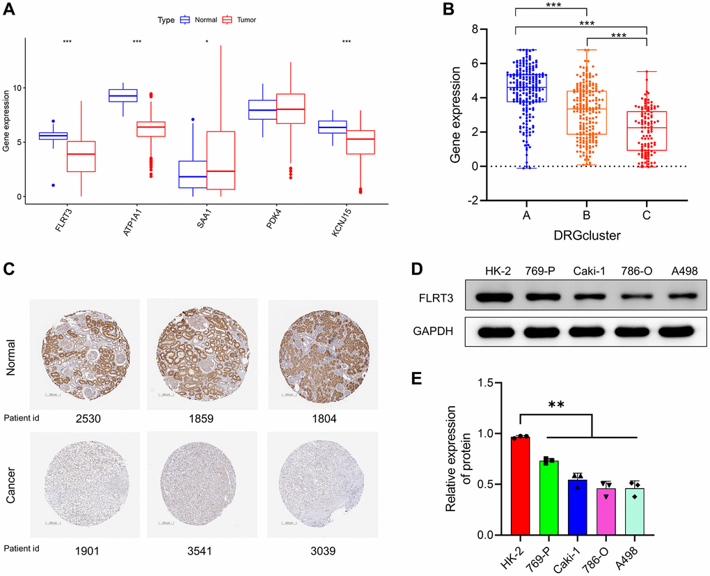 Risk scoring genes were abnormally expressed in ccRCC. (A) Expression levels of risk scoring genes between tumor and normal samples according to TCGA. (B) FLRT3 is differentially expressed in different DRG-related molecular subtypes. (C) Representative IHC images of FLRT3 from the Human Protein Atlas (HPA) database for normal and tumor samples. (D, E) Analysis of FLRT3 expression in ccRCC cells and normal kidney cells by Western blotting assay.