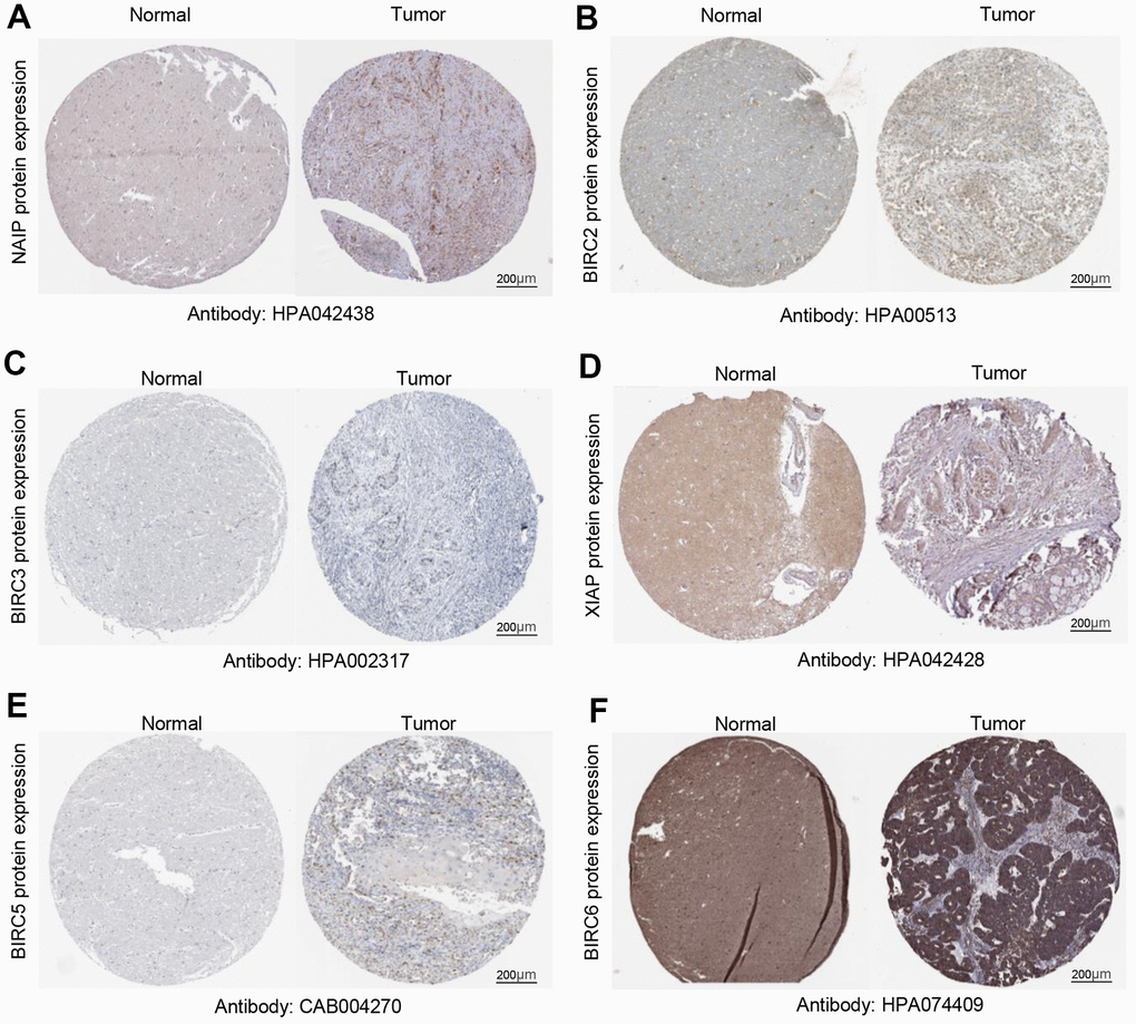 Quantification of IAP family protein expression in HNSCC. (A–F) Protein expression levels of BIRC6, BIRC3, BIRC2, XIAP, BIRC5, and NAIP in HNSCC relative to those of non-cancerous tissues.