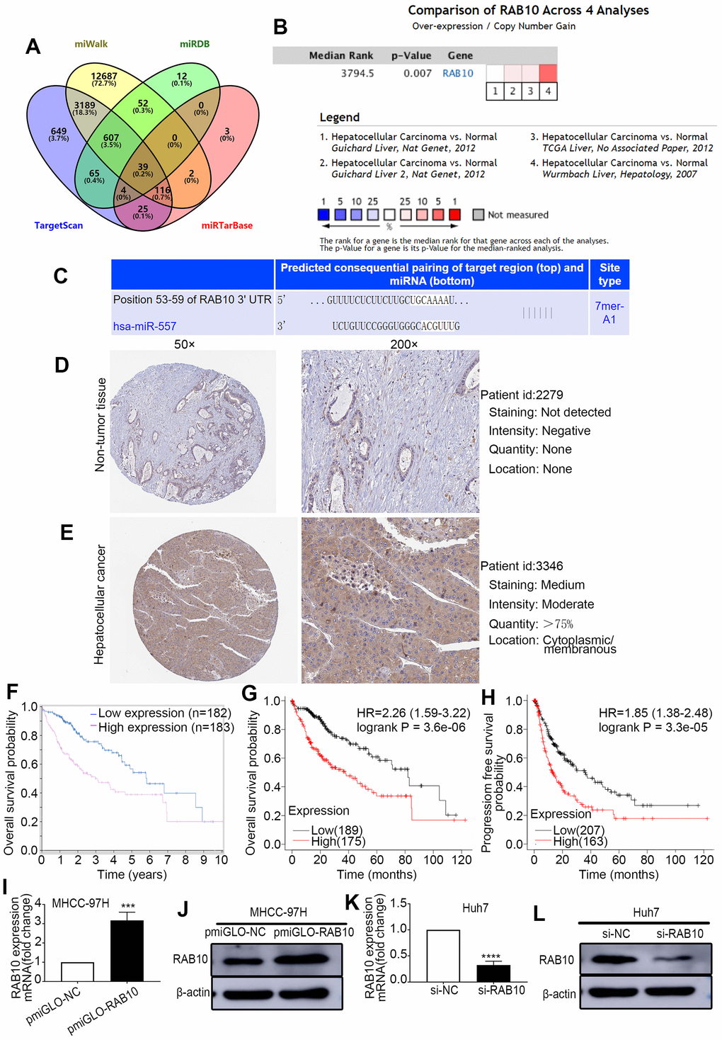 RAB10 is a downstream target gene of miR-557, is overexpressed in HCC, and is related to poor prognosis. (A) Venn diagram of TargetScan, miWalk, miRDB, and miRTarBase. (B) Meta analysis of RAB10 expression from Oncomine database. (C) Predicted binding sites of 3′-UTR of RAB10 to miR-557. (D, E) The immunohistochemical images of relative RAB10 expression in HCC tissues and paired non-tumor tissues stem from the Human Protein Atlas database (Version 23.0, https://www.proteinatlas.org/ENSG00000084733-RAB10/pathology/liver+cancer#img). (F) The relationship between RAB10 expression and overall survival from the Human Protein Atlas database. (G, H) The relationship between the expression level of RAB10 and overall survival or disease-free survival from the Kaplan–Meier plotter online database. (I–L) The transfection efficiency of pmirGLO-NC, pmirGLO-RAB10 of MHCC-97H cells, and of siNC and siRAB10 of Huh7 cells. All blots were cut prior to hybridisation with antibodies during western blotting. (***P****P