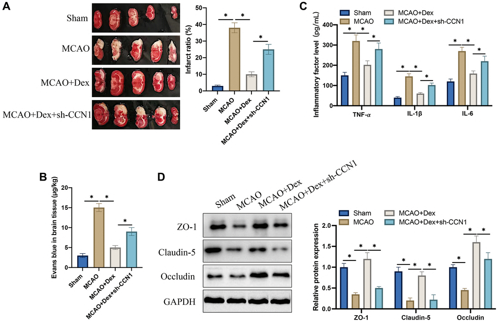 Dex suppressed cerebral ischemia injury and increased tight junction protein expression. (A) TTC staining was performed to study the infarct ratio; (B) Evans blue staining was conducted to investigate blood brain barrier injury; (C) The levels of IL-6, IL-1β, and TNF-α in serum were detected; (D) The expression levels of tight junction proteins were determined in brain tissues. *p n = 5.