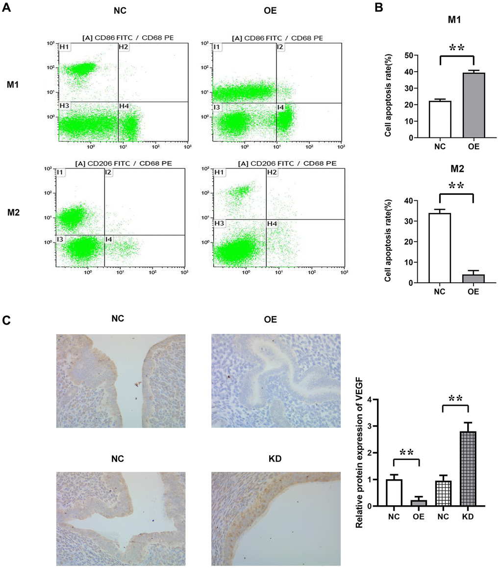 The proportion of M1 and M2 polarization in macrophages was detected by flow cytometry. (A) Flow cytometry results. (B) Statistics of the proportion of M1 and M2 polarization in macrophages; (C) Immunohistochemical staining results and relative protein expression statistics of VEGF. N = 8; **P 