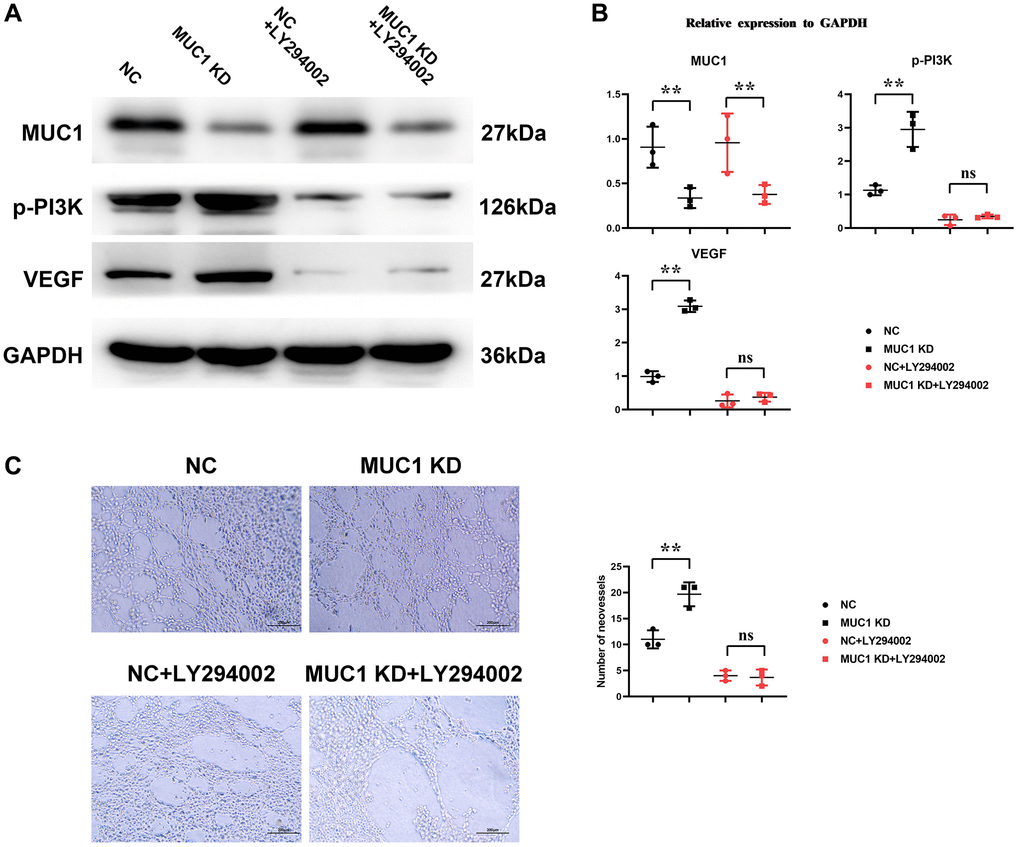 Inhibition of MUC1 can promote angiogenesis. (A) Protein bands of MUC1, p-PI3K and VEGF. (B) Statistics of relative protein expression levels of MUC1, p-PI3K and VEGF. (C) Diagram of experimental results of angiogenesis and statistics of the number of angiogenesis. N = 3; **P nsP > 0.05.