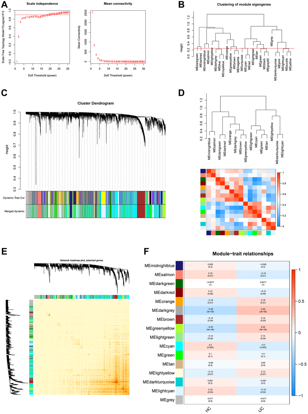 Construction of WGCNA co–expression network in training set. (A) The investigation involved the utilization of scale-free fit index and mean connectivity analysis across various soft-thresholding powers. (B) To identify and establish connections between related modules, the clustered dendrograms were truncated at 0.25 heights. (C) The WGCNA modules were assigned and represented by a colored horizontal bar in the cluster dendrograms. (D) The module feature genes were analyzed for collinearity and presented in a heatmap, where red indicates high correlation and blue indicates low correlation. (E) The topological overlap matrix (TOM) for each module was visualized in a WGCNA network heatmap. (F) Module-trait correlations. Positive correlations are represented by red and negative correlations by blue.