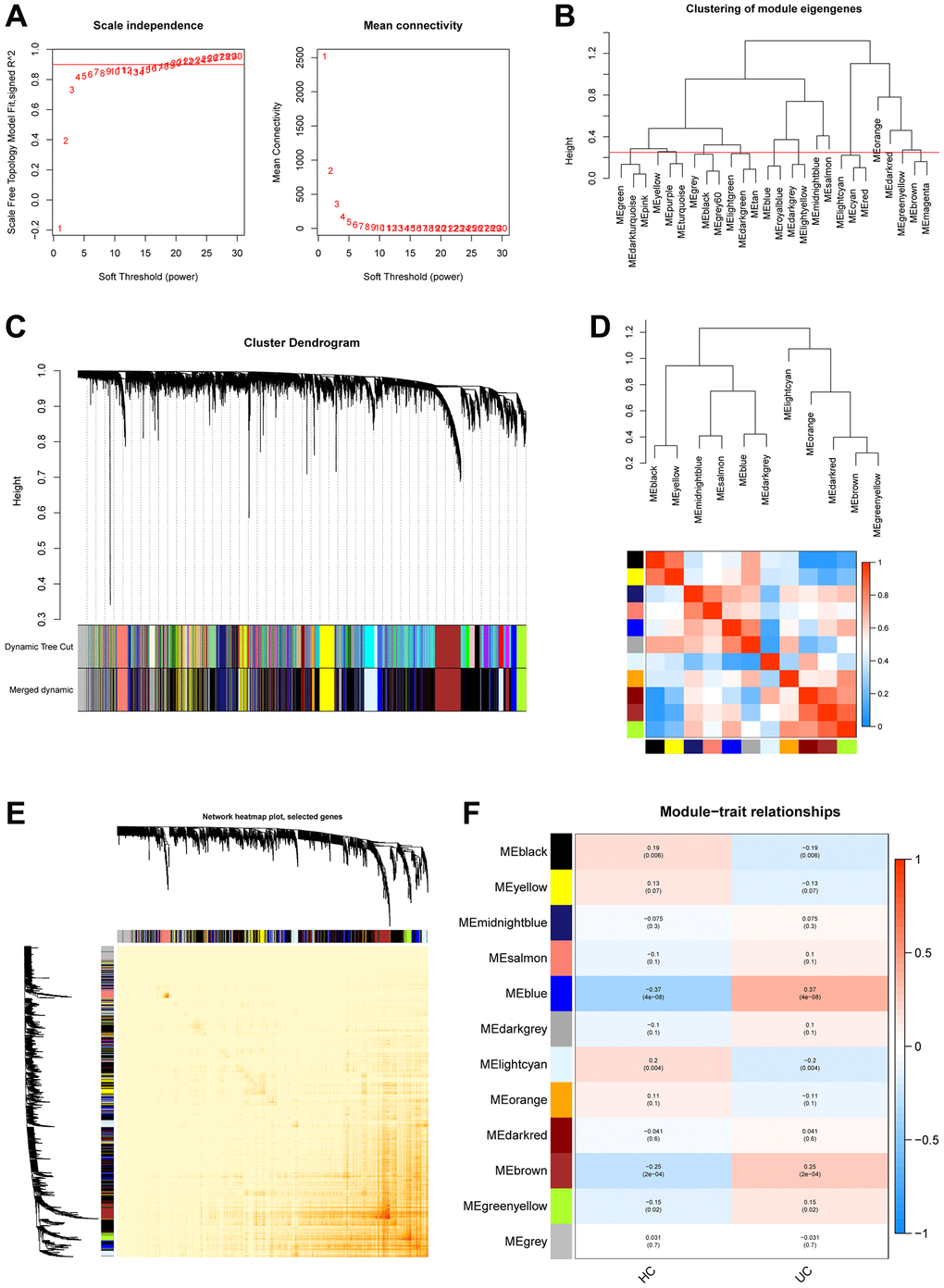 Construction of WGCNA co–expression network in validation set. (A) Scale-free fit index and mean connectivity analysis for various soft-thresholding powers. (B) Clustered dendrograms were cut at 0.25 heights to recognize and connect related modules. (C) Cluster dendrograms and module assignment for WGCNA modules. The colored horizontal bar represents the modules. (D) Collinear heat map of module feature genes. The color red represents a high correlation, whereas the color blue suggests the opposite results. (E) Visualization of the WGCNA network heatmap. The heatmap shows the topological overlap matrix (TOM) for each module. (F) Module-trait correlations. Positive correlations are represented by red and negative correlations by blue.