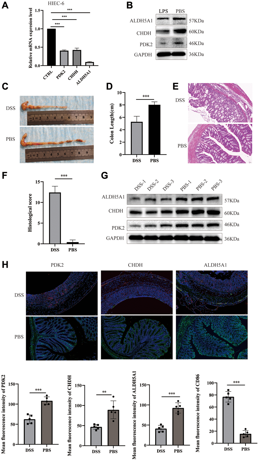 Expression of PDK2, CHDH, and ALDH5A1 in LPS-induced HIEC-6 cells and DSS-induced colitis mice. The relative mRNA (A) and protein (B) expression levels of PDK2, CHDH, and ALDH5A1 were conducted using the LPS-induced HIEC-6 cells. (C) Photographs were utilized to assess the variations in colon lengths among the groups. (D) The length of the colon in different groups. (E, F) Hematoxylin and eosin staining images and colonic histological scores of colon cross-sections in mice (n = 5). Scale bar = 50 μm. (G) Expression of PDK2, CHDH, and ALDH5A1 in the colon tissues of mice was detected using Western blotting. (H) Double immunofluorescence staining of PDK2 (labeled in green), CHDH (labeled in green), and ALDH5A1 (labeled in green) with M1 macrophages (CD86, labeled in red) at DSS induced mice. The nuclei were stained by DAPI (blue). n = 5 per group. Scale bar = 50 μm. Values are expressed as the mean ± sd (n = 5). *P **P ***P 