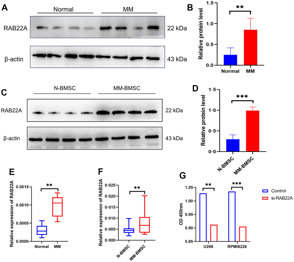 To verify the expression level of RAB22A in clinical samples and cell lines. (A–D) Western blotting results showed that the expression level of RAB22A protein in MM patients was significantly higher than that in normal people. (E, F) qRT-PCR results showed that the expression level of RAB22 gene in MM patients was significantly higher than that in normal people. (G) CCK-8 assay showed that the OD value decreased after down-regulating the expression of RAB22A in MM cell lines.