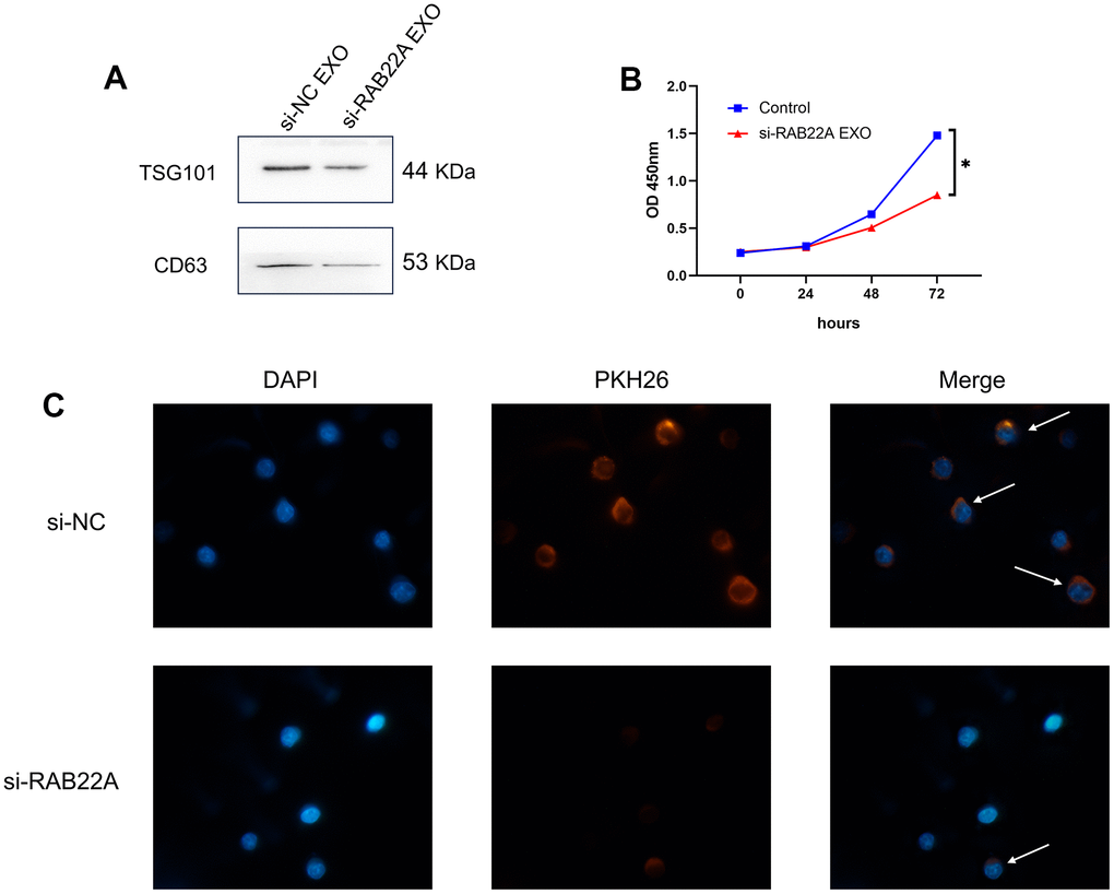 Effects of regulating RAB22A on exosomes secretion and cell proliferation. (A) Verification of exosomes by western blotting. (B) The exosomes of MSCs in control group and down-regulated RAB22A group were co-cultured with MM cell line, and the OD values of MM cells at different time points were detected by CCK-8 method. (C) The exosomes of control group and down-regulated RAB22A group were collected and stained with PKH26. The stained exosomes were co-cultured with MM cells, and the endocytosis of exosomes was observed under fluorescence microscope.