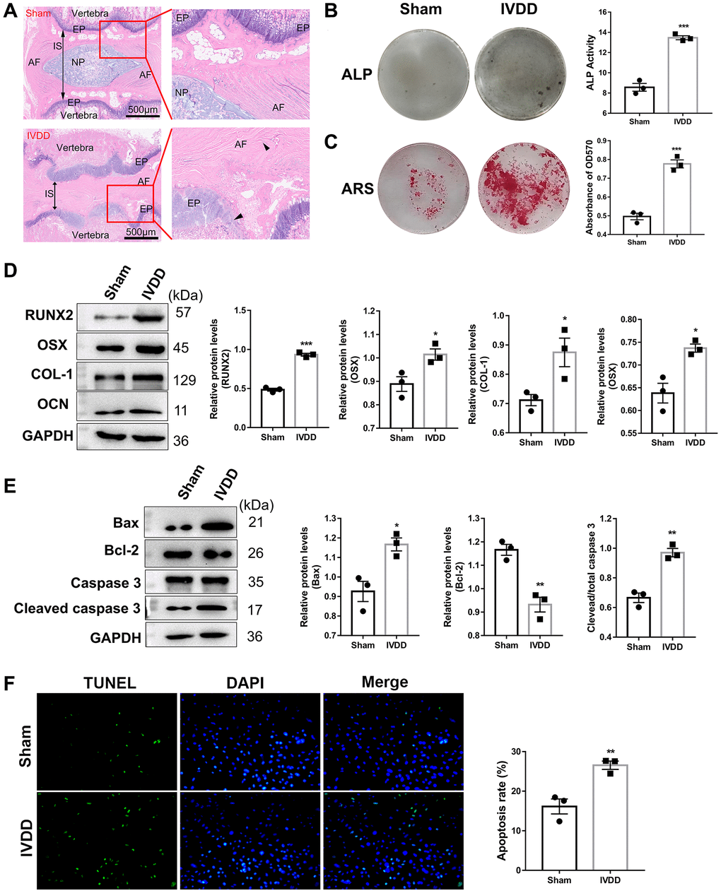 Characterization of IVDD rat model-derived Afs. (A) HE staining of Co6-7 intervertebral disk of rats from the sham and IVDD groups (n = 6). Abbreviations: AF: annulus fibrosus; NP: nucleus pulposus; IS: intervertebral space; EP: endplate. Scale bar = 500 μm. The black arrows represent AF and EP cells, respectively. (B) ALP and (C) ARS staining assays were used to evaluate the osteogenic differentiation level (n = 3). (D) The markers for osteogenic differentiation were detected using a western blotting assay (n = 3). (E) A western blotting assay examined apoptosis-related protein levels. (n = 3) (F) TUNEL assay was performed to analyze the apoptosis of AFs (n = 3). (*p **p ***p 