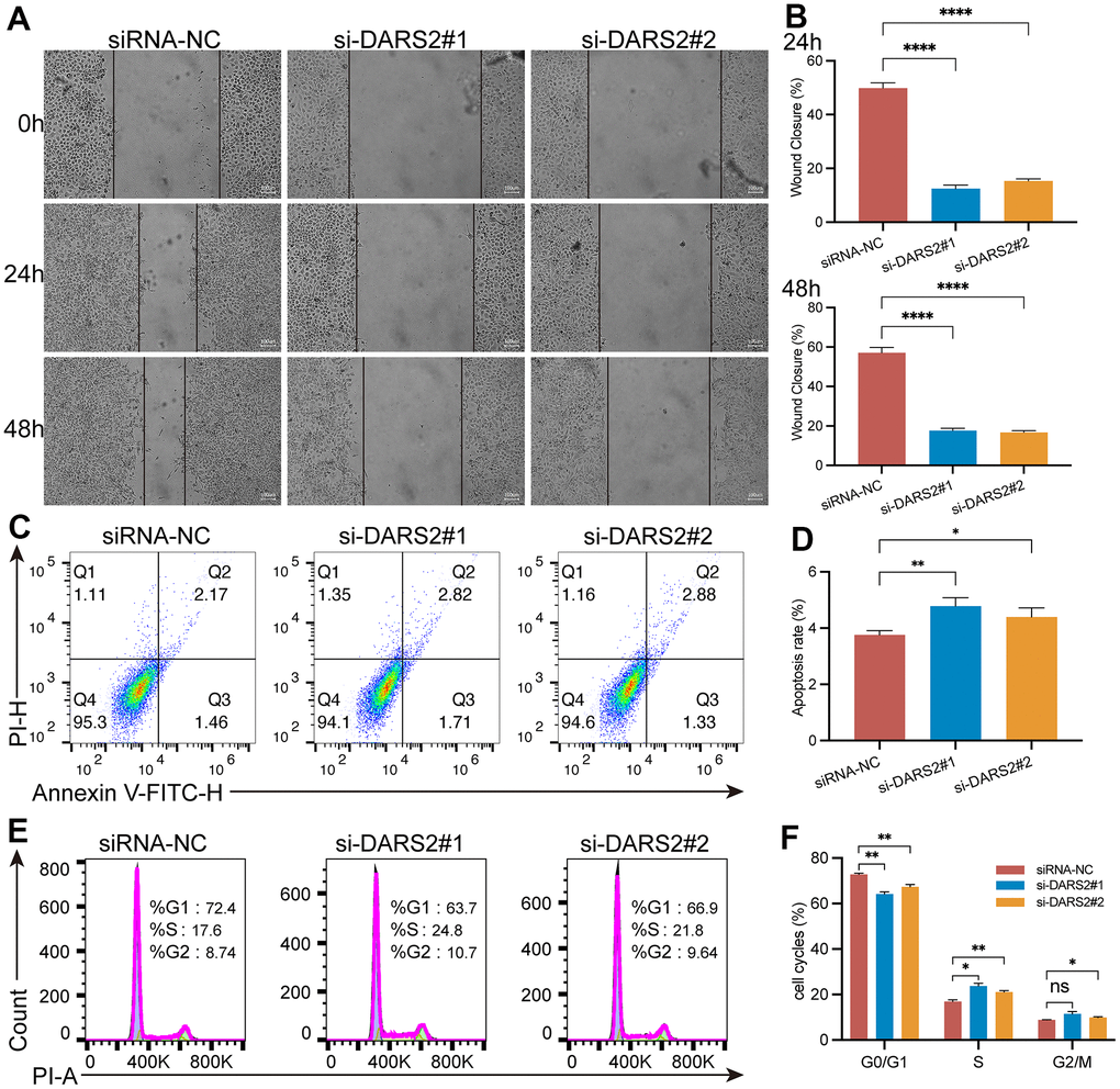 DARS2 knockdown affects wound healing, apoptosis and cell cycle in ESCA cells. (A, B) The analysis of wound healing in the present study revealed a significant reduction in wound healing rate upon downregulation of DARS2 expression. (C, D) Furthermore, the results demonstrated that downregulation of DARS2 expression significantly increased the number of apoptotic cells in the experimental group. (E, F) Flow cytometry analysis revealed a significant arrest of tumor cells in the S phase and G2/M phase in the experimental group compared to the control group. *p 