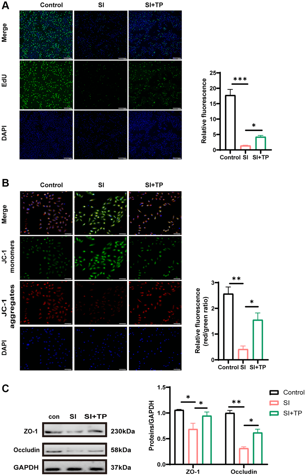 Effects of TP on proliferation, mitochondrial membrane potential and tight junction protein. (A) The EdU assay was used to analyze the proliferation-suppressing effect of SI on RPE cells. DAPI for nuclear staining (blue). EdU-positive cells (green) were counted to calculate the percentage. Scale bar, 200 μm. (B) Mitochondrial membrane potential was detected by the JC-1 fluorescence ratio. The transition from red fluorescence to green fluorescence represents the decrease of cell membrane potential. Scale bar, 200 μm. (C) Protein levels of occludin and ZO-1 were detected by Western blot with GAPDH as the loading control. The bar graphs show the results of analysis. Values are the mean ± SD; n = 3; *P **P ***P 