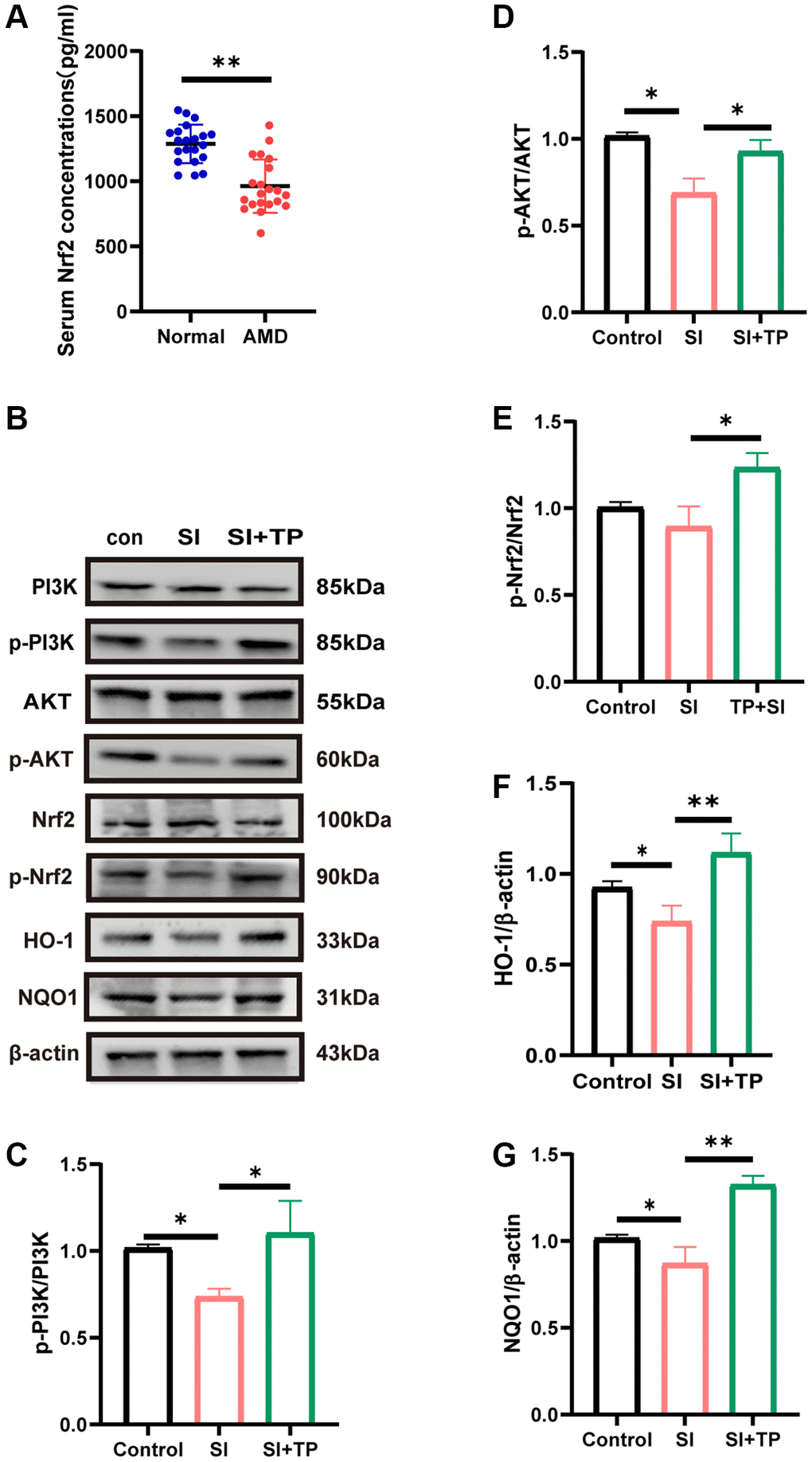 Activation of the PI3K/Akt pathway was involved in the protective effect of triptolide on ARPE-19 cells. (A) Serum Nrf2 levels in normal subjects and AMD patients detected by ELISA, n = 3. (B) Cells were treated with 20 nM triptolide (TP) for 6 h and then treated with sodium iodate (SI) for 24 h. Western blot analysis was performed using the corresponding antibodies. Quantitative analyses of p-PI3K/PI3K (C), p-Akt/Akt (D), p-Nrf2/Nrf2 (E), HO-1 (F) and NQO1 (G) by ImageJ software. Data are shown as mean ± standard deviation (SD) (n = 3); Abbreviation: NS: not significant. *p **P 