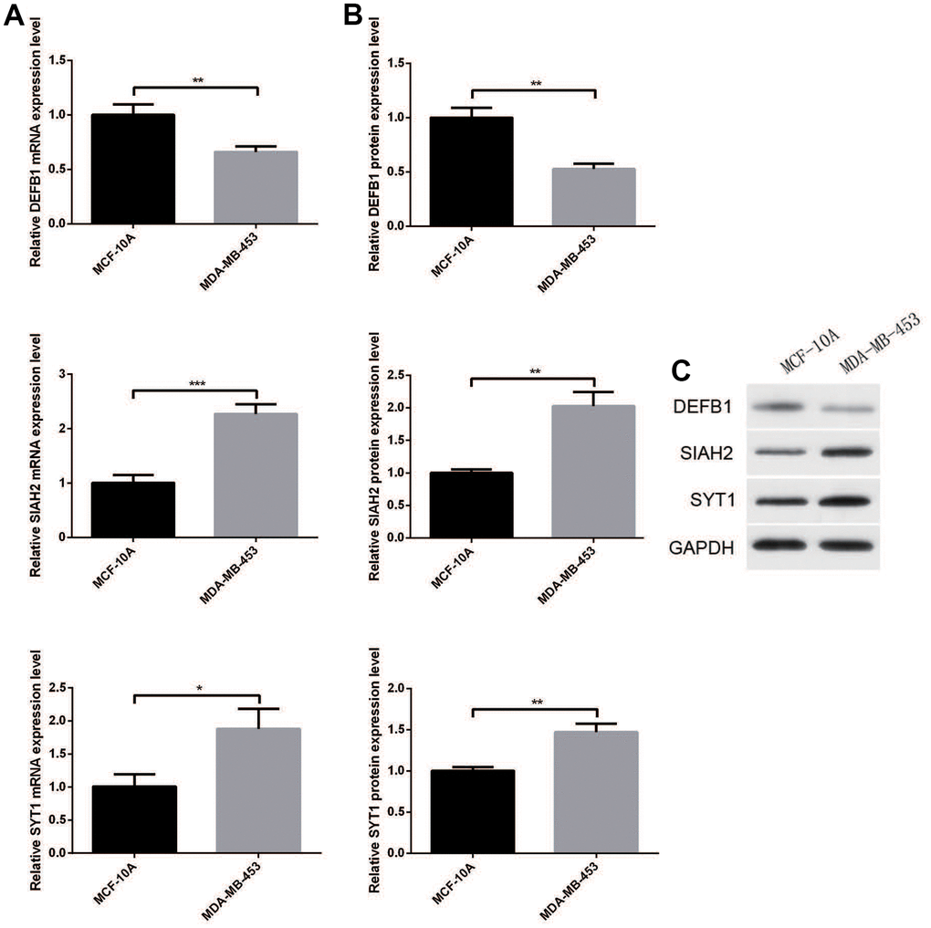 (A) RT-qPCR and (B, C) Western blotting analysis of DEFB1, SIAH2, and SYT1 expression in BC cell lines and adjacent cell lines. Statistical significance at different levels was reported for the results. Statistical significance at the level of * 