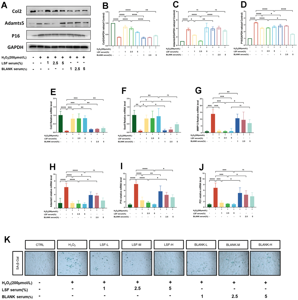 LSF regulates chondrocyte anabolic-catabolic homeostasis and inhibits chondrocyte senescence. (A–D) Western blotting assessed the expression of Col2, Adamts5 and P16 proteins in chondrocytes. (E–J) qRT-PCR was performed to detect the expression of Col2, Sox9, MMP13, Adamts5, P16 and P21 in chondrocytes. (K) Cellular senescence was assessed by SA-β-gal staining. All data represent mean ± SD. Compared to the control group, **P 2O2-stimulated group, *P 