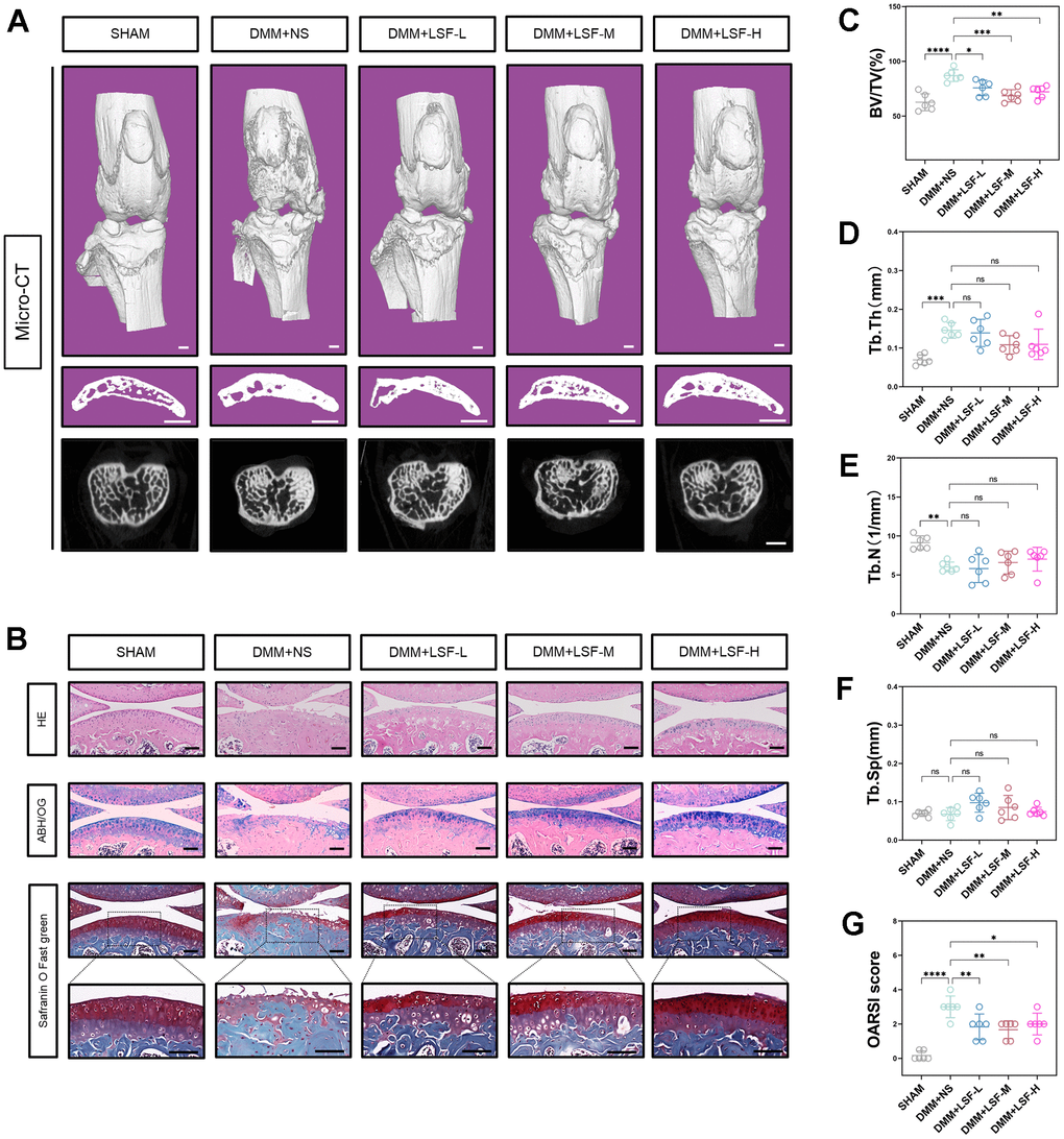 LSF attenuates the deterioration of OA in DMM mice. (A) Representative images of Micro-CT 3D reconstruction of mice knee joints. Mice were randomly assigned to treatment groups with different concentrations of LSF (0.08, 0.17, and 0.35 g/kg) after DMM surgery and received LSF via intragastric administration for 4 weeks. All mice were executed at 8 weeks postoperatively, Scale bar: 1 mm. (B) Typical images of mouse knee joints stained with HE, ABH/OG and Safranin O Fast green staining after pathologic sectioning. Scale bar: 50 μm. (C–F) Quantitative data of BV/TV, Tb.Th, Tb.N, and Tb.Sp of the subchondral bone in each group of mice at 8 weeks postoperatively. (G) OARSI score of the cartilage. All data represent mean ± SD. Compared to the SHAM group; **p ≤ 0.01, ***P 