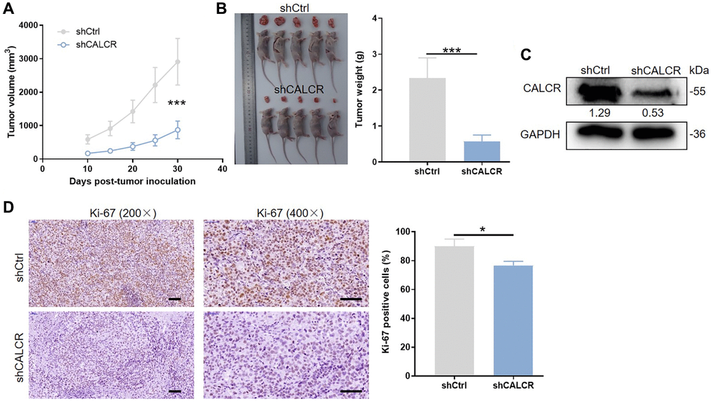 CALCR is indispensable for in vivo tumor formation. (A) Tumor size was measured as shown, and the tumor growth curve was graphed based on tumor size. (B) All mice and corresponding tumor tissues in shCtrl group and shCALCR group was shown as the figure. Right panel presented the tumor. (C) CALCR protein level in tumor tissues isolated from mice in shCtrl group and shCALCR group was determined by western blot assay. (D) Representative Ki-67 staining images of tumor tissues in shCtrl group and shCALCR group. The quantitative statistical analysis for Ki67 expression was shown on the right. Scale bar represent 50 μm. Results were presented as mean ± SD. ***p 