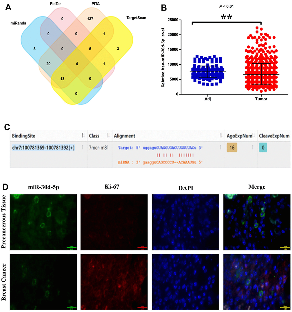 miRNA target prediction software: miRanda, PicTar, PITA and TargetScan (A). Relative has-miR-30d-5p expression level in adjacent tissue and tumor (B). miR-30d-5p information, including binding site, gene sequence and miRNA sequence (C). miR-30d-5p, Ki-67, DAPI Immunofluorescence staining in pericancerous tissue and breast cancer (D). Scale bar=20 μm. **, P