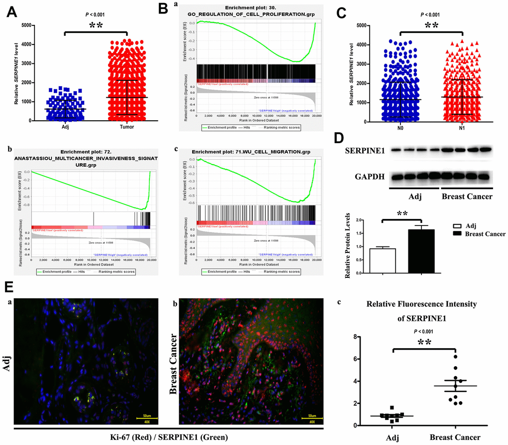 SERPINE1 expression level is higher in tumor than in adjacent tissue (A). Statistics showed proliferation, invasion and migration of breast cancer cell increase as the SERPINE1 expression increasing (B). PCR data demonstrate SERPINE1 level is significantly different between N0 and N1 (C). Western blot shows that SERPINE1 expressed higher level in tumor than in adjacent tissue (D). Ki-67 and SERPINE1 immunofluorescence staining in adjacent tissue and breast cancer (a, b); fluorescence intensity of SERPINE1 is expressed higher in breast cancer (c) (E). Scale bar=50 μm. **, P