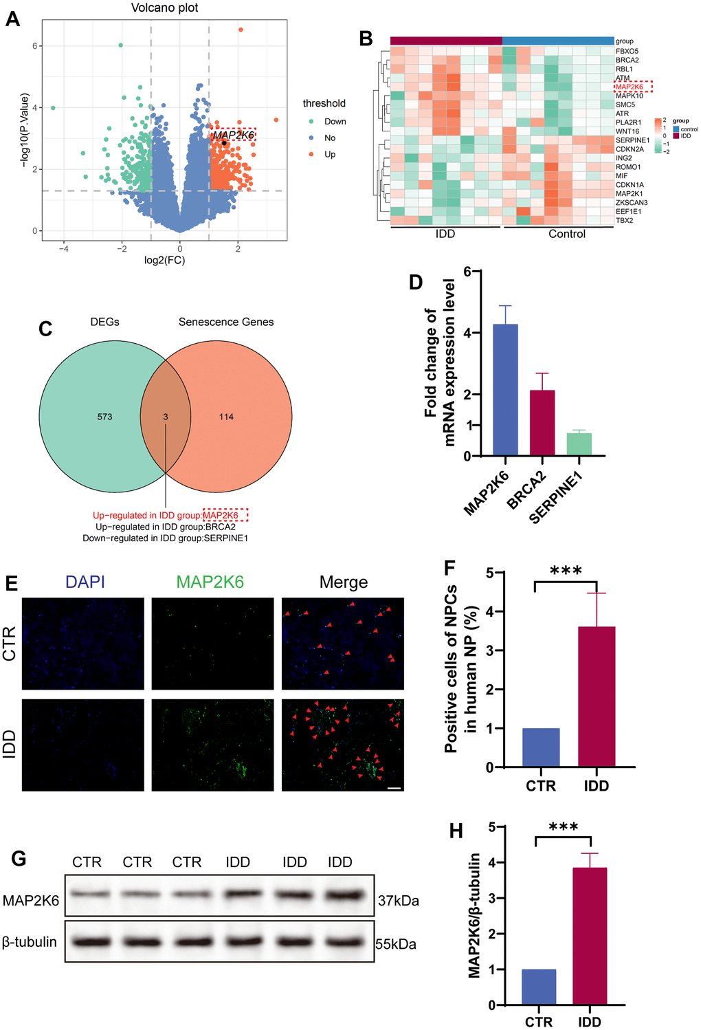 MAP2K6 exhibited heightened expression levels in IDD. (A) Volcano plot illustrating the differential gene expression in human NP samples Note: GSE186542, GSE185728, GSE167199, (Control group [CTR]: n = 8, Intervertebral Disc degeneration [IDD]: n = 8). (B) Heatmap depicting the top 20 differentially expressed genes (DEGs) in human NP. (C) Venn diagram illustrating the intersection of DEGs between the CTR and IDD groups and senescence-related genes. (D) RT-qPCR results presenting the expression levels of candidate genes (MAP2K6, BRCA2, and SERPINE1) in degenerative NP cells. (E, F) Immunofluorescence staining (IF) and corresponding quantitative analysis of MAP2K6 in CTR and IDD human NP samples. (Original magnification 100×, scale bar = 400 μm; Red arrow: positive cells). (G, H) Western Blot analysis and quantitative assessment of MAP2K6 expression in human NP samples. CTR, control group; IDD, intervertebral disc degeneration group. n = 3 each group. Data are represented as mean ± standard deviation. ***p 