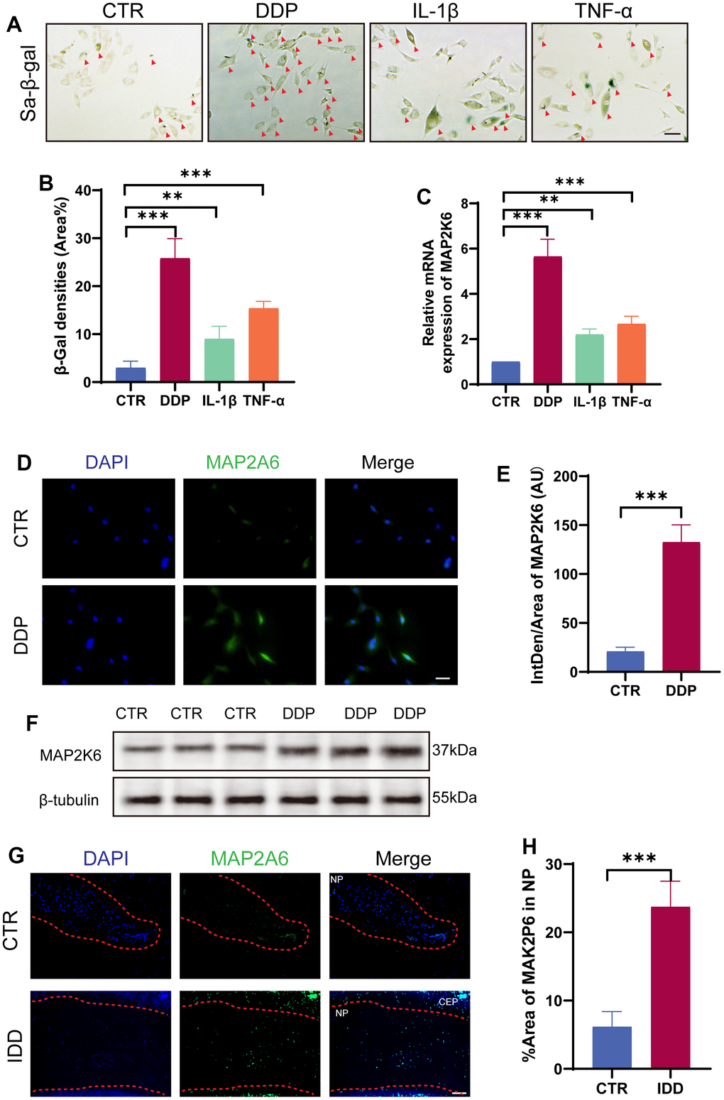 MAP2K6 was upregulated in DDP-induced cellular senescence model. (A, B) Rat NP cells were exposed to DDP (mM, 24h), IL-1β (100ng/ml, 24h), and TNF-α (50ng/ml) to establish an in vitro senescence NP cell model, which was confirmed by SA-β-gal staining and the corresponding quantitative analysis. (Original magnification 200×, scale bar = 200 μm; Red arrow: positive cells). (C) RT-qPCR results depict the expression levels of MAP2K6 following different treatments. (D, E) Immunocytochemistry (ICC) staining and the accompanying quantitative analysis of MAP2K6 in control (CTR) or DDP-treated Rat NP cell models. (Original magnification 400×, scale bar = 100 μm). (F) Western Blot analysis illustrating the expression of MAP2K6 in control (CTR) or DDP-treated Rat NP cell models. (G, H) Immunofluorescence (IF) staining of IVDs tissue in rat model and quantitative assessment of MAP2K6 expression in control (CTR) or IDD rats after 8 weeks of operation. (original magnification 400×, scale bar = 100 μm). CTR, control group; DDP, cisplatin treatment. n = 3 each group. Data are represented as mean ± standard deviation. ns: not significant, *p 