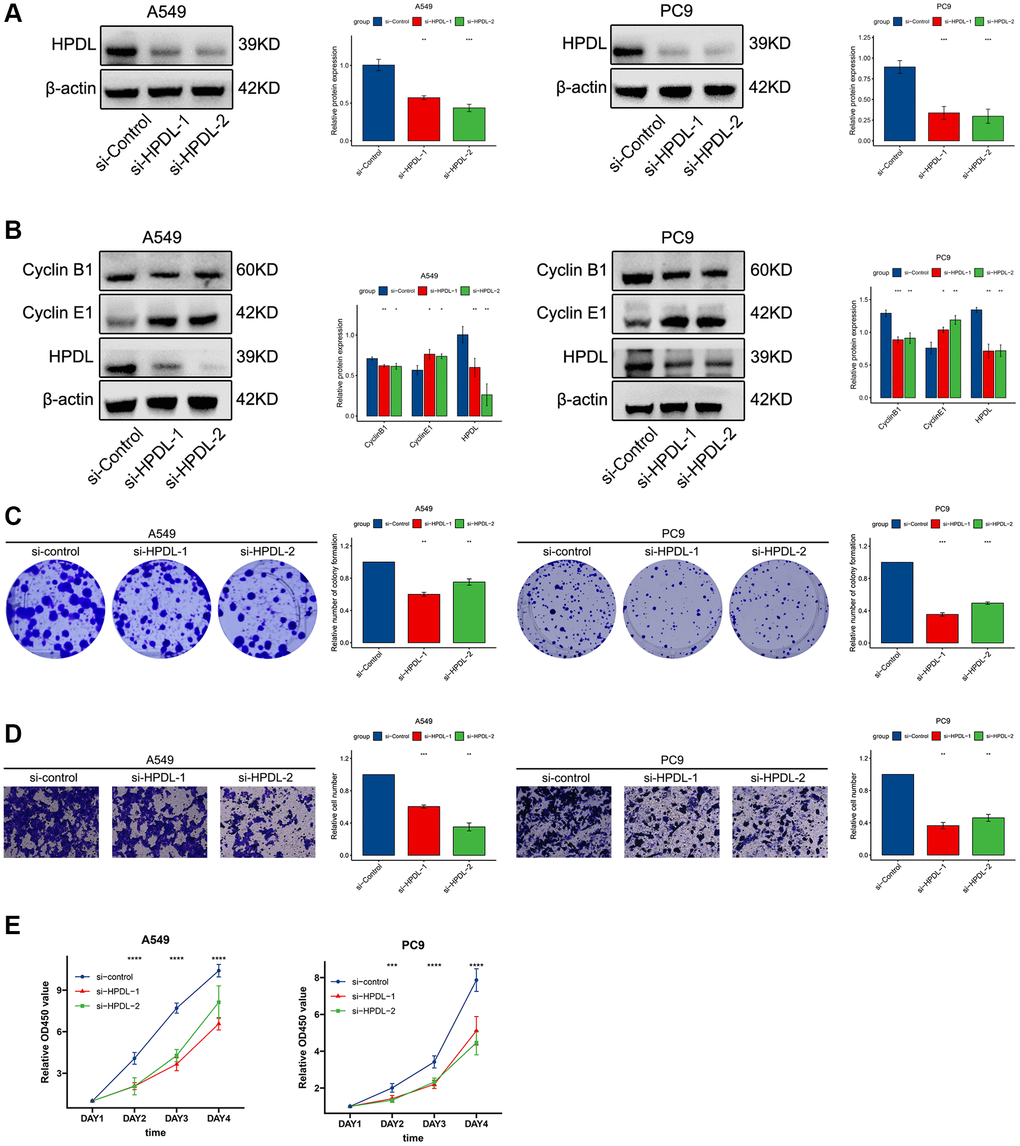 HPDL promote tumor growth, migration, and cell cycle in LUAD cells. (A) The level of HPDL transfection with siRNA were analyzed by WB. (B) The expression of Cyclin B1, Cyclin E1, and HPDL was analyzed by WB. (C) Colony formation assays showed that knockdown of HPDL inhibited LUAD cell growth. (D) Transwell assay showed that HPDL silencing inhibited the migrating of A549 and PC9 cells. (E) CCK8 assay was performed to determine the proliferation of HPDL knockdown. The labelled asterisk indicated the statistical p-value (*p **p ***p 