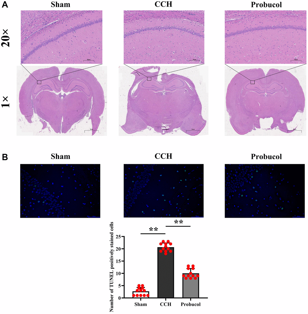 Probucol attenuates CCH-induced neuronal death in the hippocampus. (A) Sham, CCH, Probucol group respectively Hippocampal slices are stained with HE (scale bar = 50 μm or 2 mm). (B) TUNEL staining results and the number of apoptotic cells.