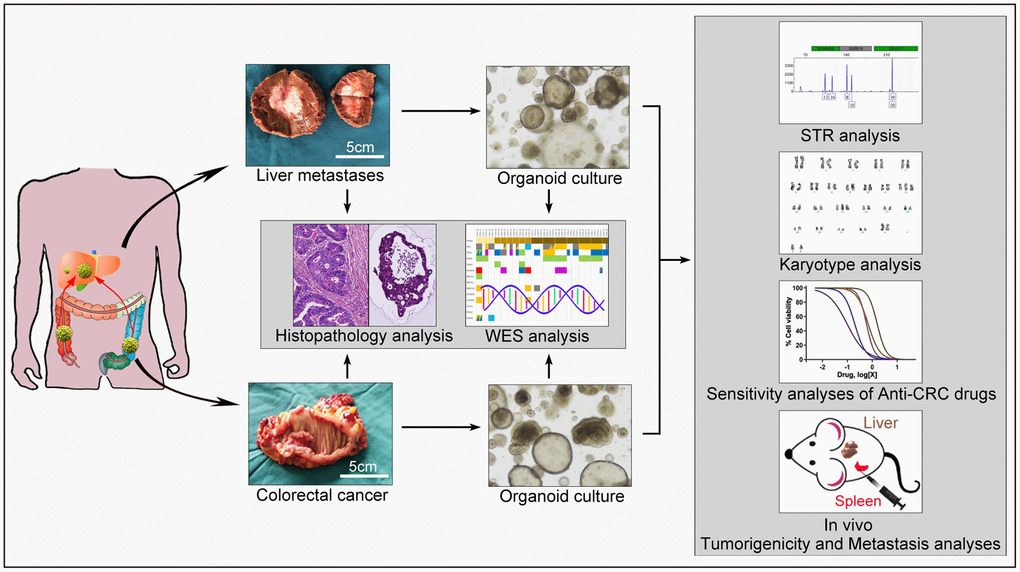 Overview of the procedure. Tissues from primary colorectal cancer and liver metastases were obtained and then divided into three parts: two parts were placed in liquid nitrogen and 4% paraformaldehyde, separately, for molecular and histopathological examinations, and the other part was immediately placed on ice and transported to the laboratory for tumor cell isolation and organoid culture. Whole-exome sequencing and histopathological analysis were conducted to determine the concordance between the tumor organoids and corresponding tumors. The organoids were subjected to STR, karyotype analysis, in vitro drug sensitivity tests, and in vivo animal model construction.