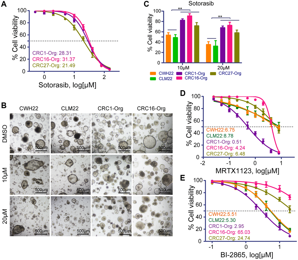 Drug treatment sensitivities of different organoids to KRAS G12C, KRAS G12D and pan-KRAS inhibitors. (A) Dose-response curves of KRAS G12D-mutated organoids (CRC1-Org and CRC16-Org) and RAS-unmutated organoid (CRC27-Org) exposed to increasing concentrations of sotorasib (a KRAS G12C inhibitor), and the corresponding IC50 values. (B) Representative images of CWH22, CLM22, CRC1-Org, and CRC16-Org organoids exposed to sotorasib at concentrations of 10 μM and 20 μM (scale bars, 200 μm). (C) Quantitative analysis of the viability of CWH22, CLM22, CRC1-Org, CRC16-Org and CRC27-Org (with different KRAS mutation backgrounds) following exposure to 10 μM and 20 μM sotorasib (n = 3, data represented as the mean ± SD, **p D, E) Dose-response curves and IC50 values for (D) the KRAS G12D inhibitor (MRTX1133) and (E) the pan-KRAS inhibitor (BI-2865) for organoids with different KRAS mutation statuses.