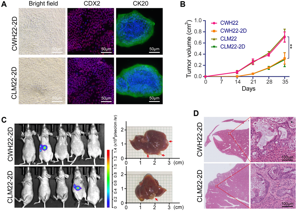 Tumorigenicity of adherent CWH22-2D and CLM22-2D cells. (A) Bright-field images of CWH22-2D/CLM22-2D cells (left panel); and immunofluorescent staining images of CK20 and CDX2 (middle and right panels) from CWH22-2D/CLM22-2D cells. Scale bars, 50 μm. (B) Subcutaneous tumor growth curves were plotted according to the monitored tumor size every seven days for 35 days. The tumors were derived from CWH22-2D/CLM22-2D cells and CWH22/CLM22 organoids. (C) Bioluminescence imaging of mice with liver metastases 42 days after splenic injection of CWH22-2D and CLM22-2D cells, and livers with metastatic lesions harvested from mice receiving splenic injections of CWH22-2D and CLM22-2D cells. (D) Representative image of the entire liver lobe with metastases, and focal magnification. Scale bars, 100 μm.