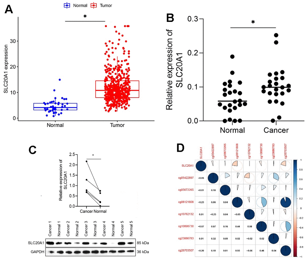 Exaggerated SLC20A1 expression levels in HNSCC. (A, B) SLC20A1 mRNA expression between the HNSCC specimens and nearby sound tissues from TCGA database and qRT-PCR analysis. (C) SLC20A1 protein expression in the HNSCC specimens and nearby sound ones from Western blotting analysis. (D) DNA methylation modification associated with SLC20A1 expression in HNSCC. *, P