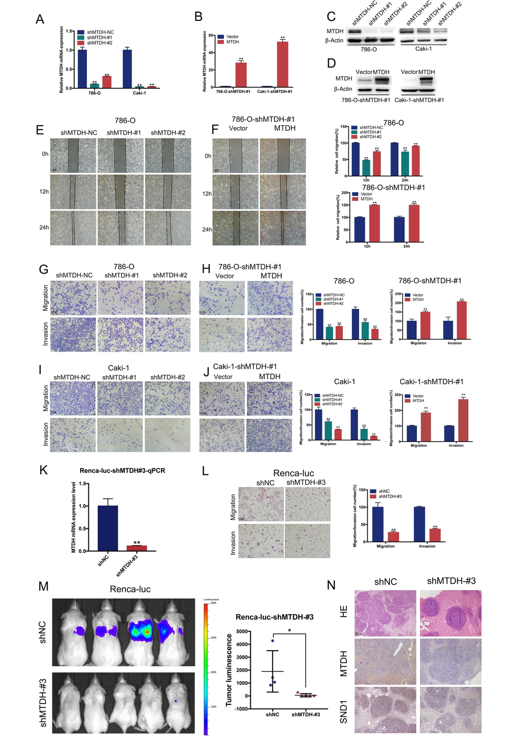 MTDH promotes cell migration and invasion of ccRCC cells. (A–D) RT-qPCR and western blot analyses of ccRCC cells infected with a lentivirus-mediated MTDH-overexpressing vector (D) or MTDH shRNAs (C). (E–F) Wound-healing assay. Representative images of wound-induced cell migration by the 786-O-shMTDH, 786-O-#1-MTDH and control cells(4x). (G–J) Representative images of transwell migration and invasion assay of MTDH-knockdown cells and MTDH-overexpressed cells(10x). (K) RT-qPCR analyses of Renca-luc cells infected with a lentivirus-mediated MTDH shRNAs. (L) Representative images of transwell migration and invasion assay of Renca-luc-shMTDH#3(10x). (M) Tail vein-injected Renca-luc metastasis model. Representative IVIS images of mice injected mouse MTDH-silenced or control cells and analysis of tumor luminescence representing lung metastasis measured on day 21. Five mice per group (Renca-luc-shNC ccRCC cells failed in tail vein injection in one mice.) (N) Lung metastasis was confirmed by H&E and IHC- MTDH staining(10x).