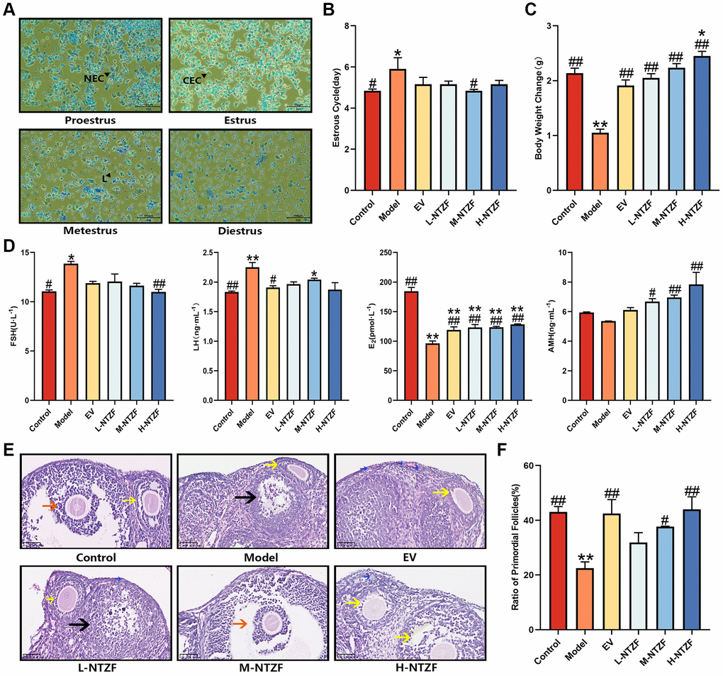 NTZF can improve the estrous cycle, body weight, serum sex hormone levels and ovarian primordial follicle differentiation. (A) Representative pictures of different estrous cycles (×200 magnification). NEC indicates nucleated epithelial cells, CEC indicates cornified epithelial cells, L indicates leukocytes. (B) Statistical figure of estrous cycle, n = 8. (C) Statistical chart of the difference in body weight of mice before and at the end of the experiment, n = 8. (D) The concentration changes of FSH, LH, E2 and AMH in serum of mice, n = 4. (E) Representative images of HE staining (×400 magnification). Blue arrows indicate primordial follicles, yellow arrows indicate growing follicles, orange arrow indicates mature follicles, and black arrow indicates atretic follicles. (F) Statistics of the ratio of primordial follicles in the ovary of mice. The ratio of primordial follicles = the number of primordial follicles/the total number of follicles ×100%, n = 3. (*p **p #p ##p 