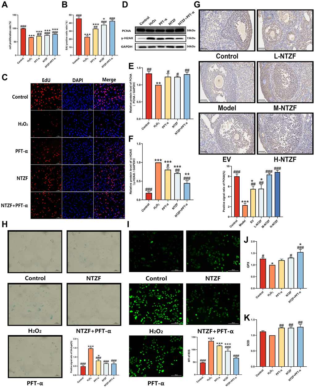 NTZF alleviated OGCs senescence and improved antioxidant capacity. (A) The cell proliferation rate was detected by CCK-8. (B, C) Cell proliferation was detected by EdU cell proliferation staining (×200 magnification). The ratio of EdU positive cells = the number of EdU stained cells/the number of DAPI stained cells ×100%. (D–F) The protein expression of PCNA and γ-H2AX was detected by western blot. (G) The levels of PCNA in the ovaries of mice were detected by IHC (×400 magnification). (H) SA-β-gal staining was used to detect cell senescence (×400 magnification). Blue staining indicated cell senescence. (I) The intracellular ROS level was detected by DCFH-DA probe. Green fluorescence indicated ROS expression. (J) The level of intracellular GPX. (K) The level of intracellular SOD content (*p **p ***p n = 3; #p ##p ###p 2O2 group, n = 3).